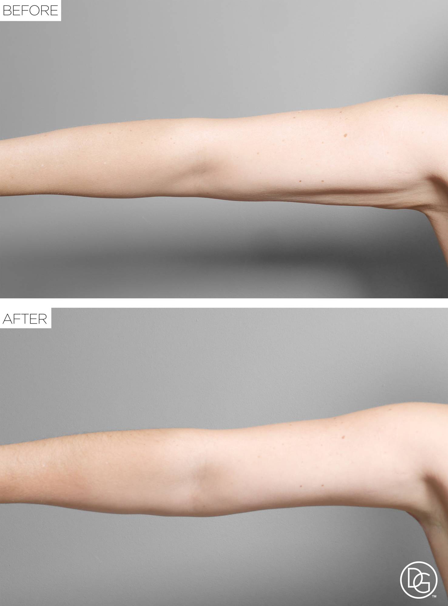 Before & After Image