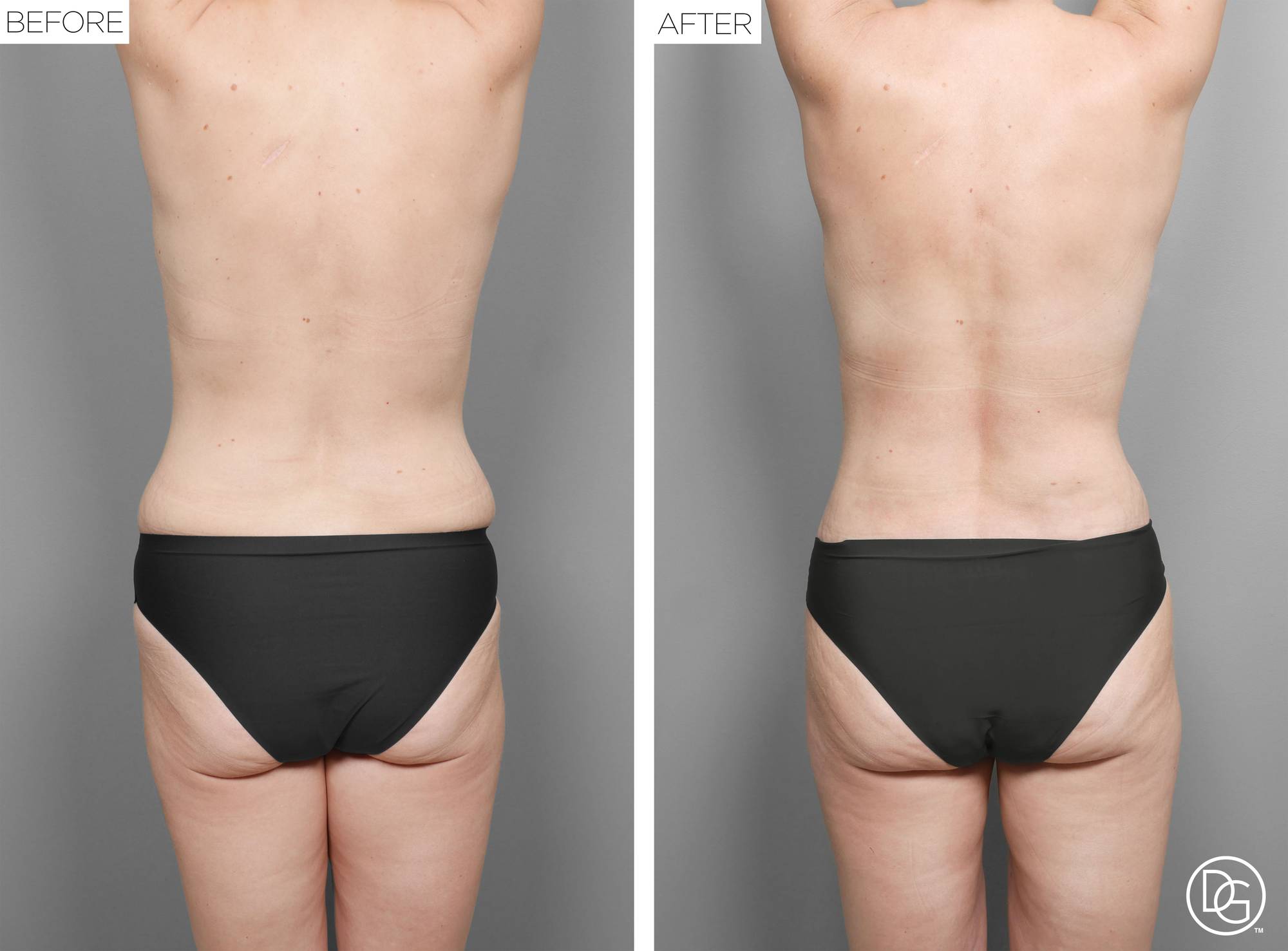 Before & After Image