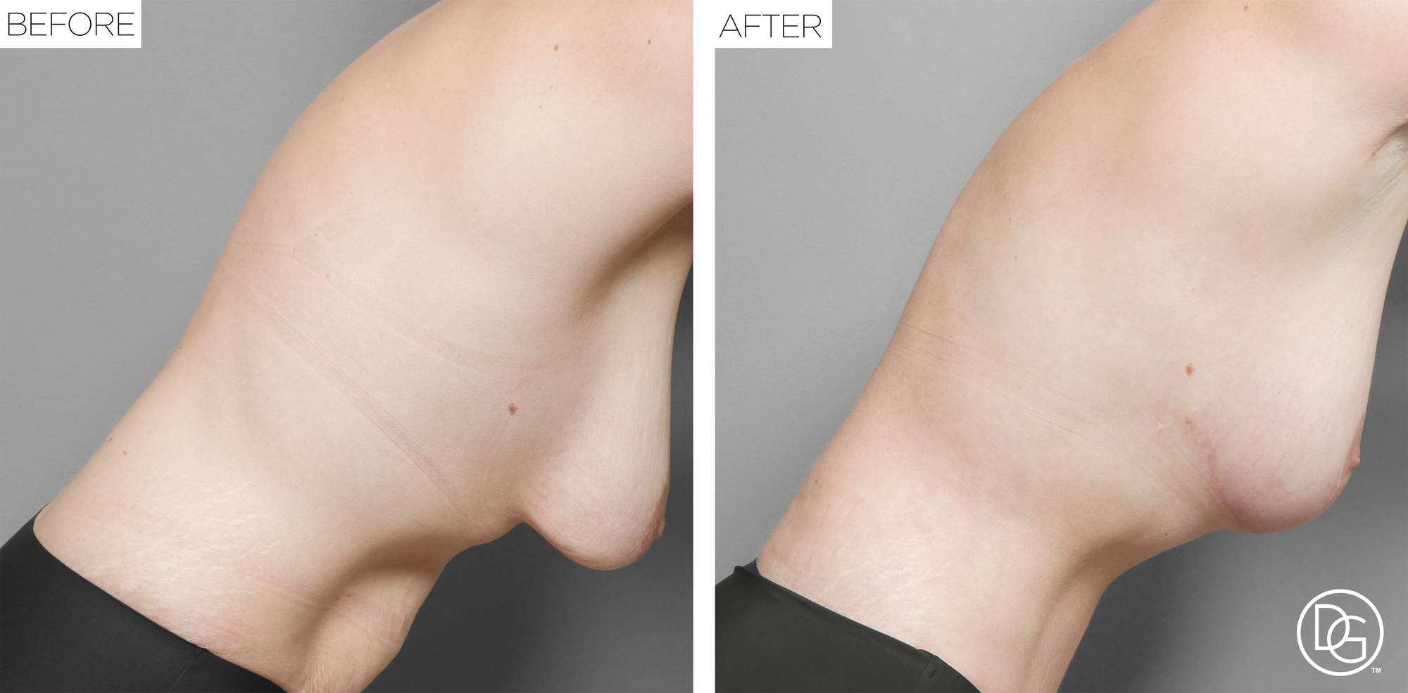 Before & After Image