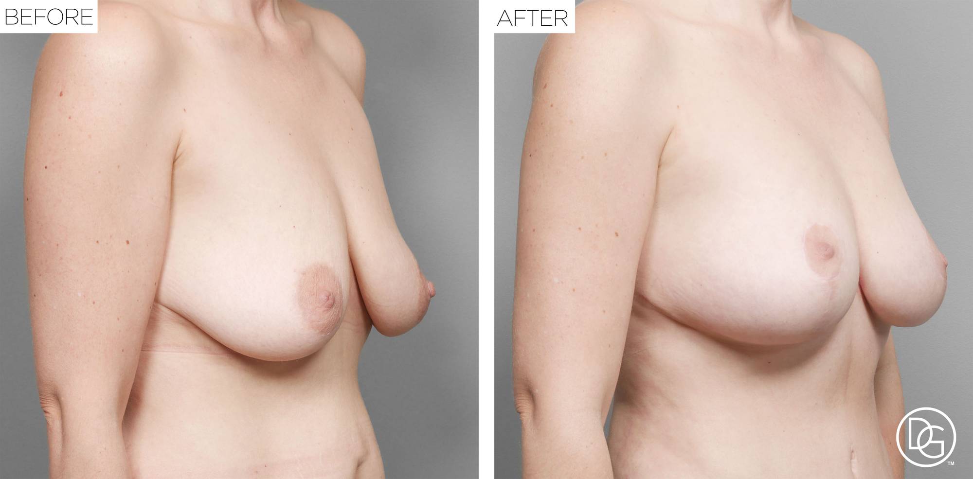 Before & After Image