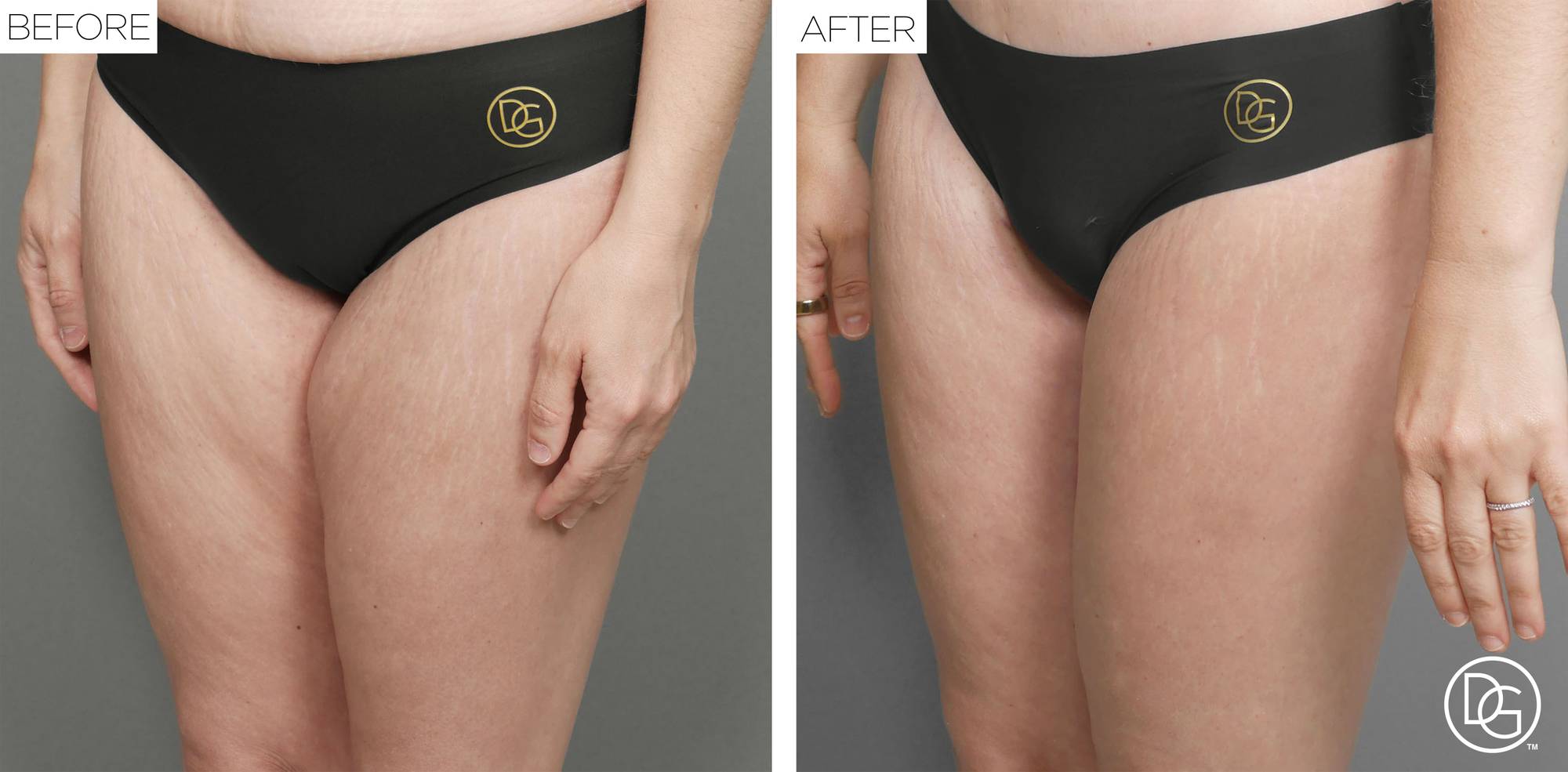 Before & After Image