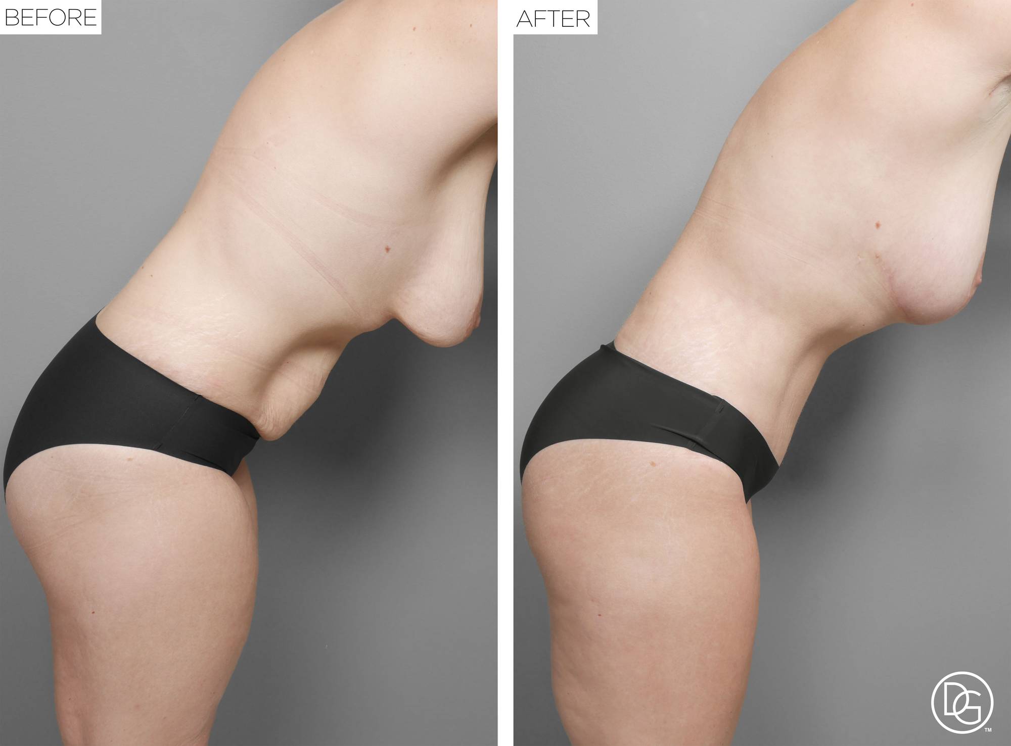 Before & After Image