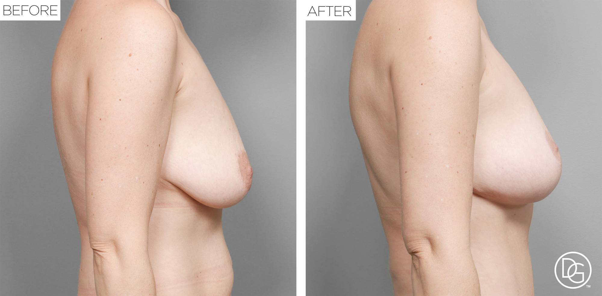 Before & After Image