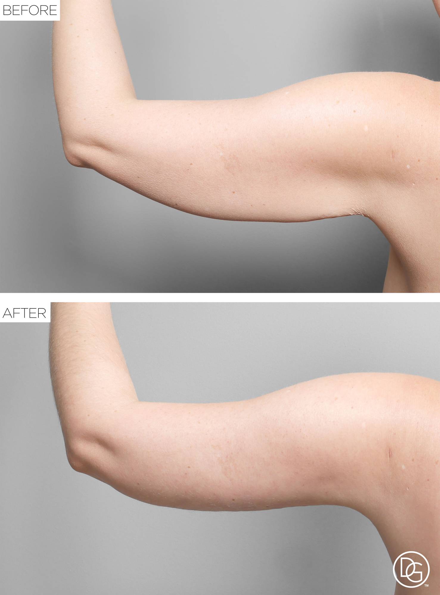 Before & After Image