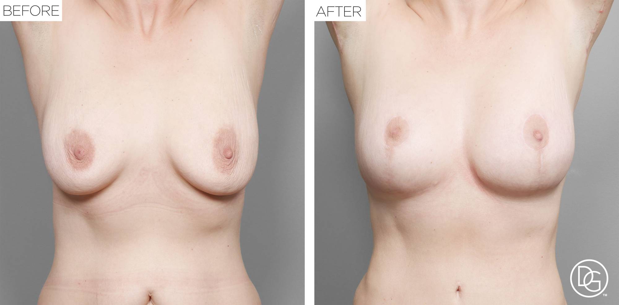 Before & After Image