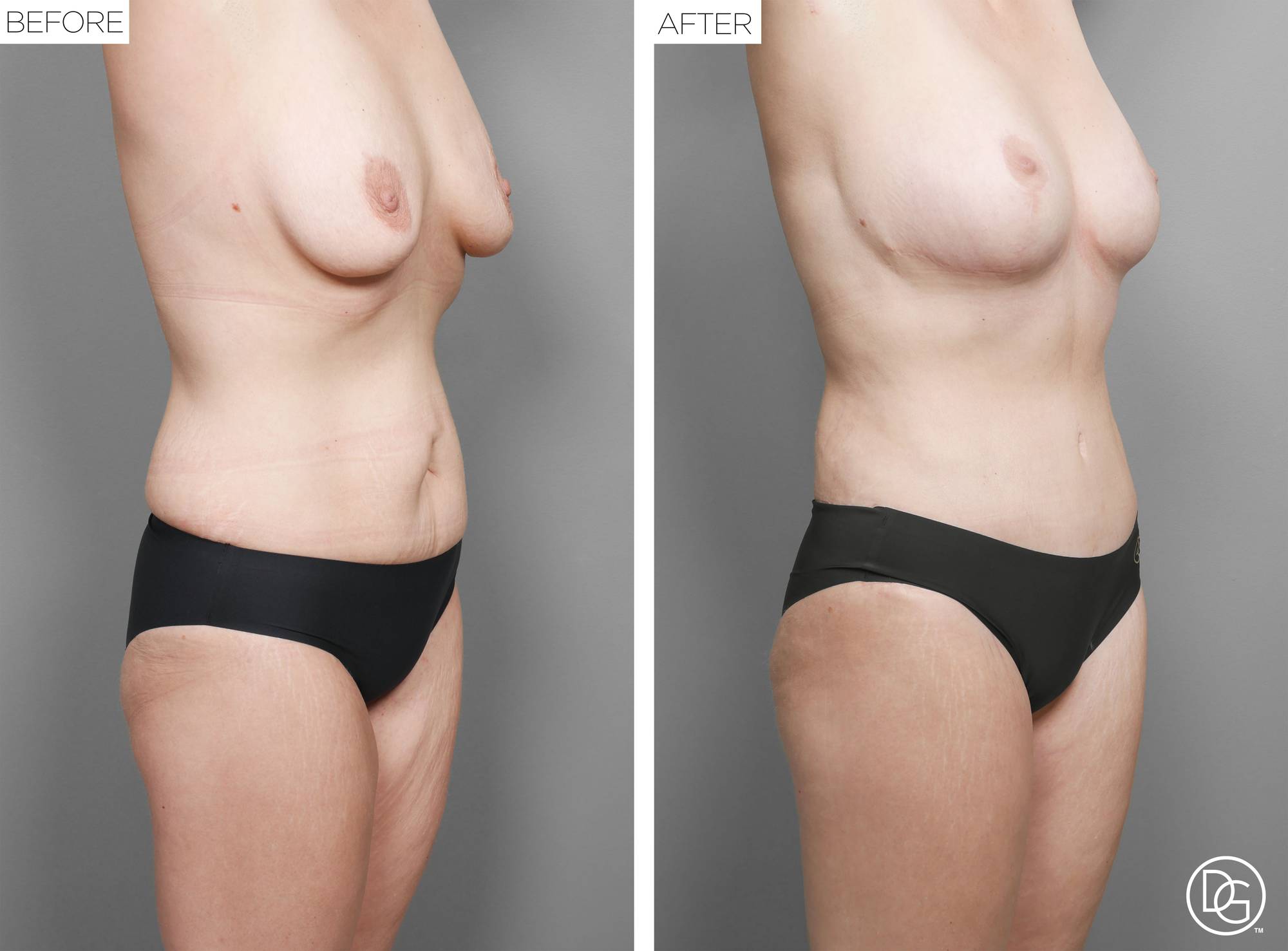 Before & After Image