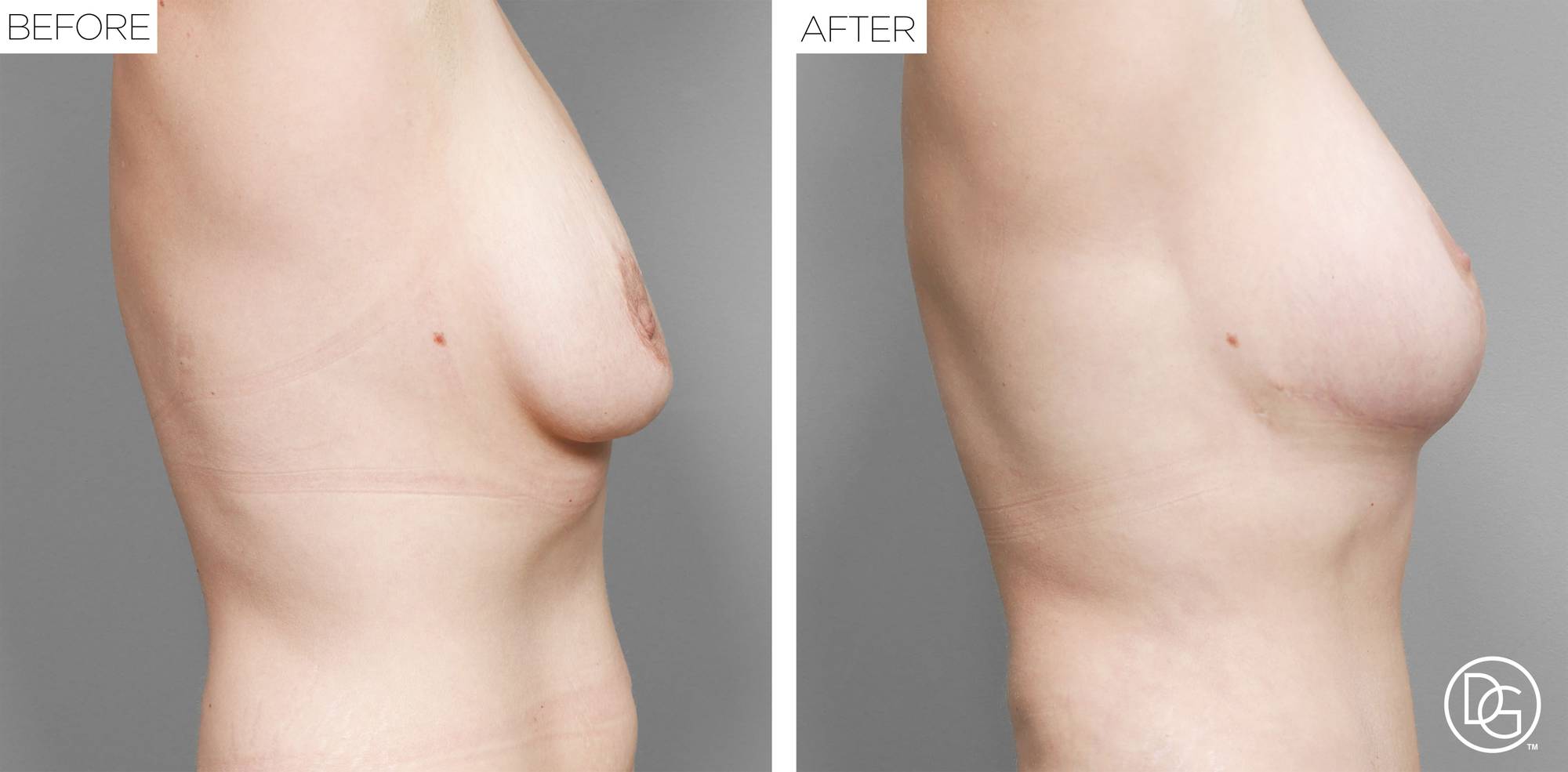 Before & After Image