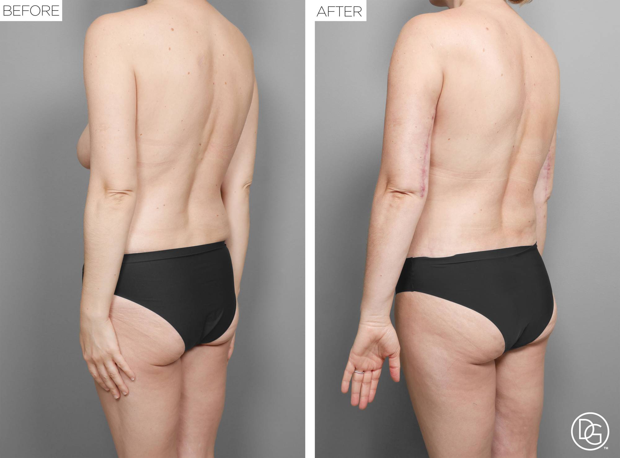 Before & After Image