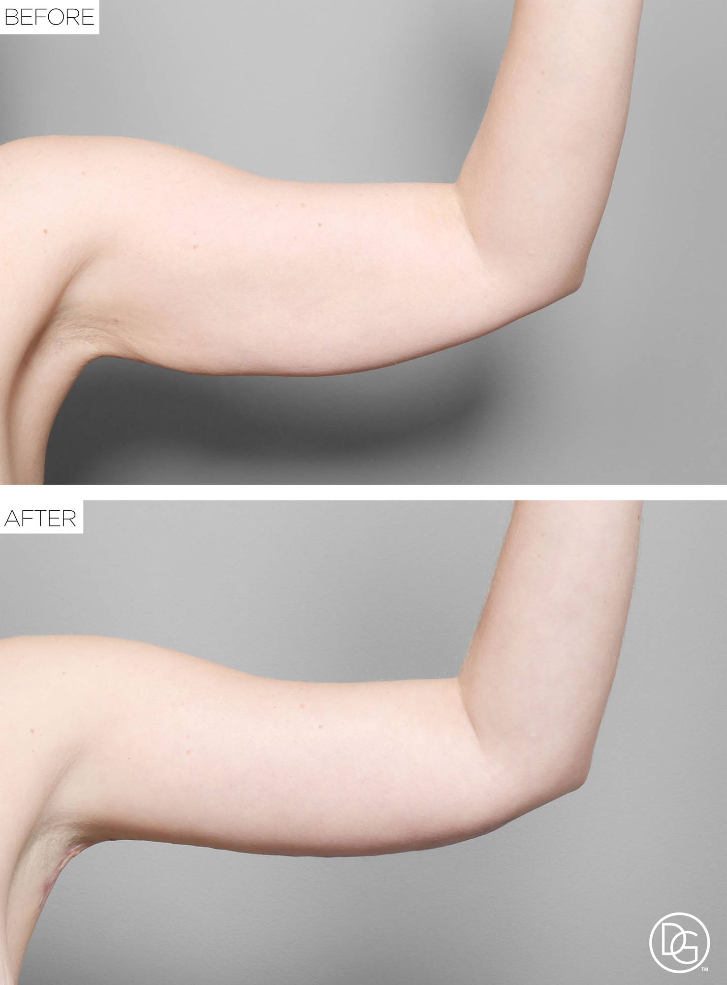 Before & After Image