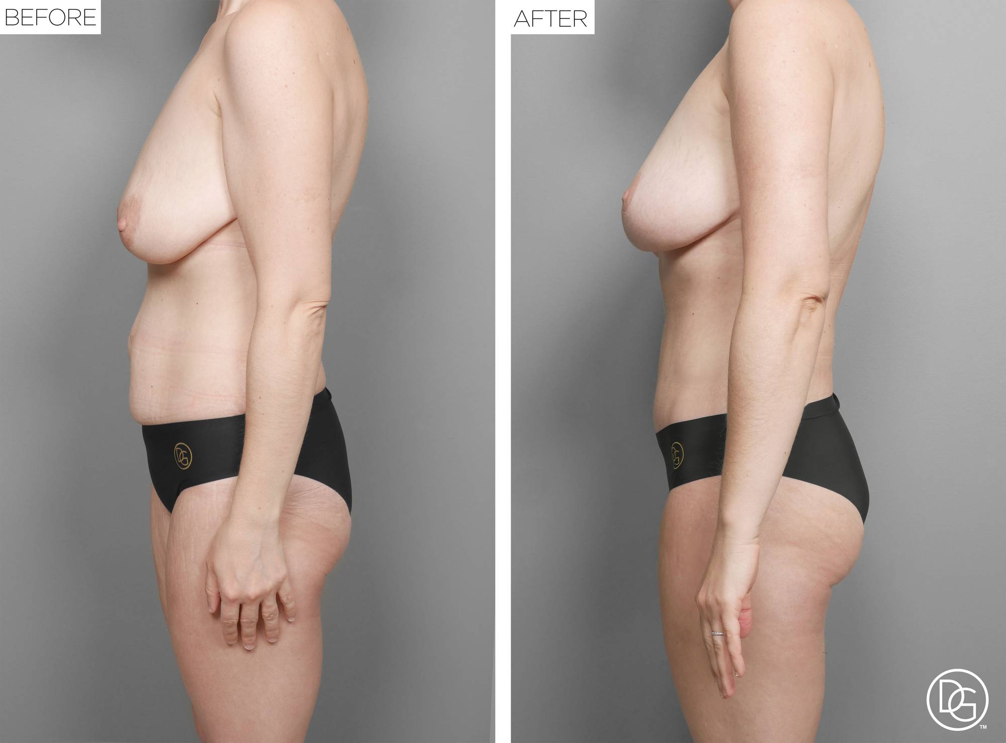 Before & After Image