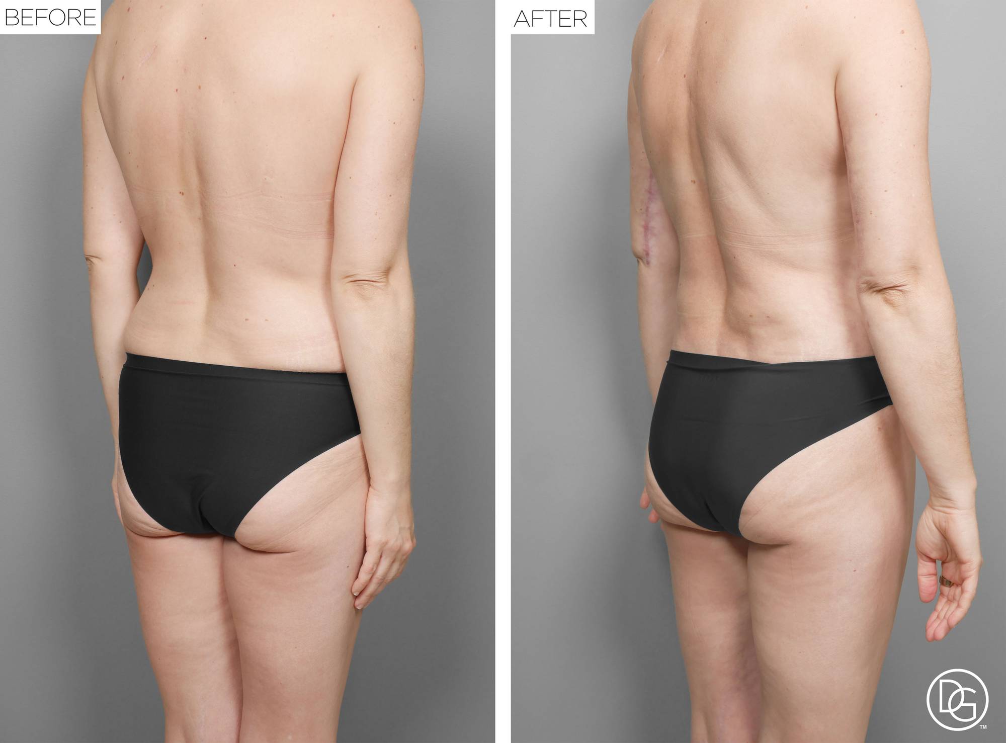 Before & After Image