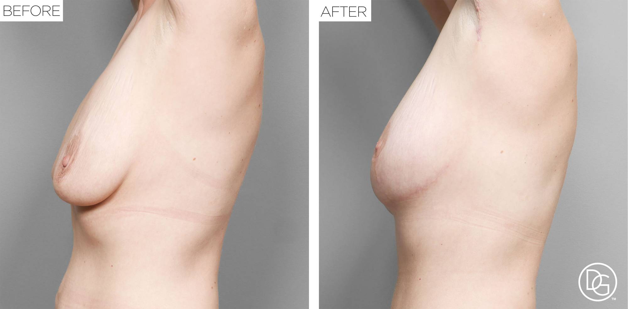 Before & After Image