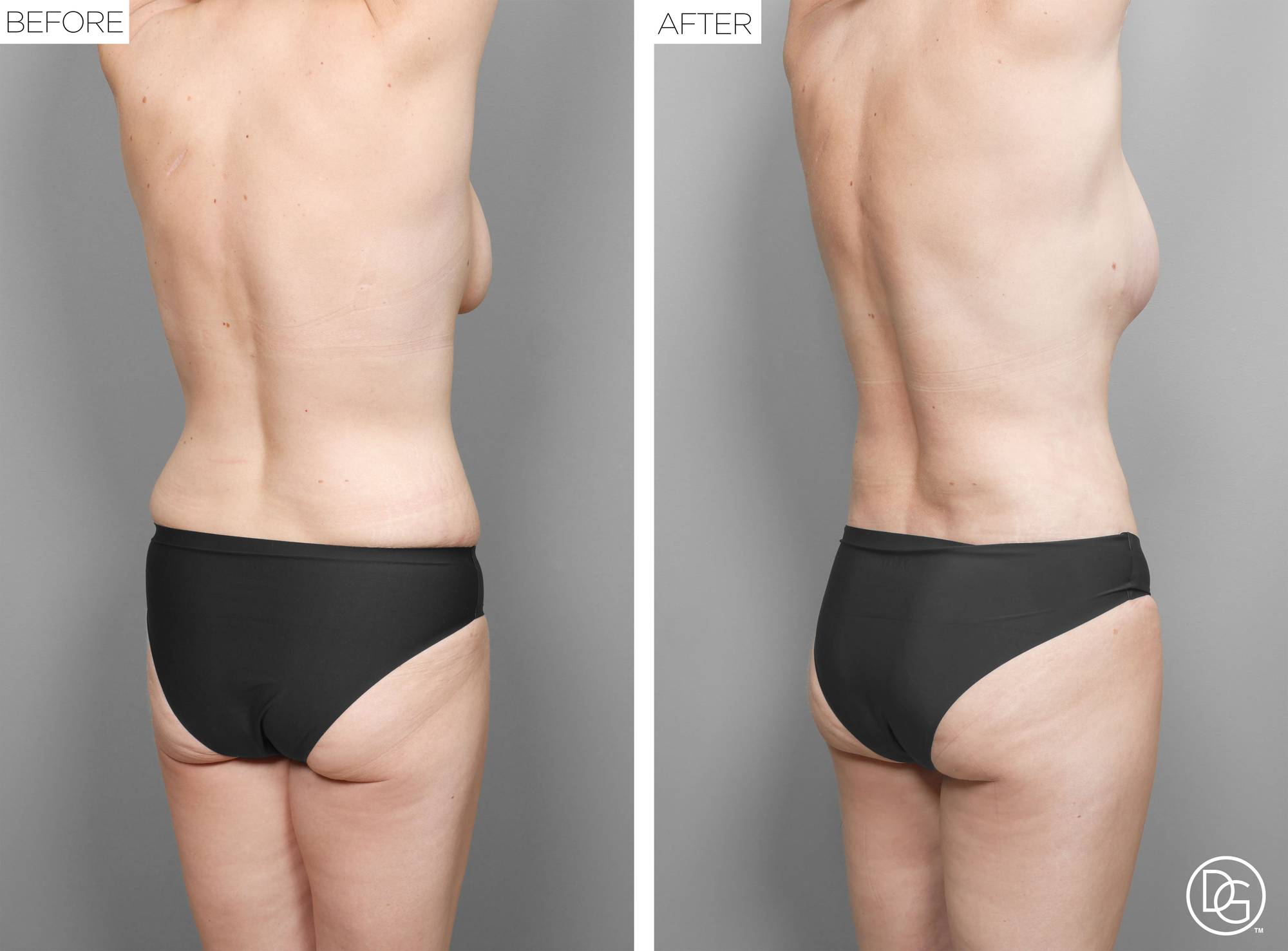 Before & After Image