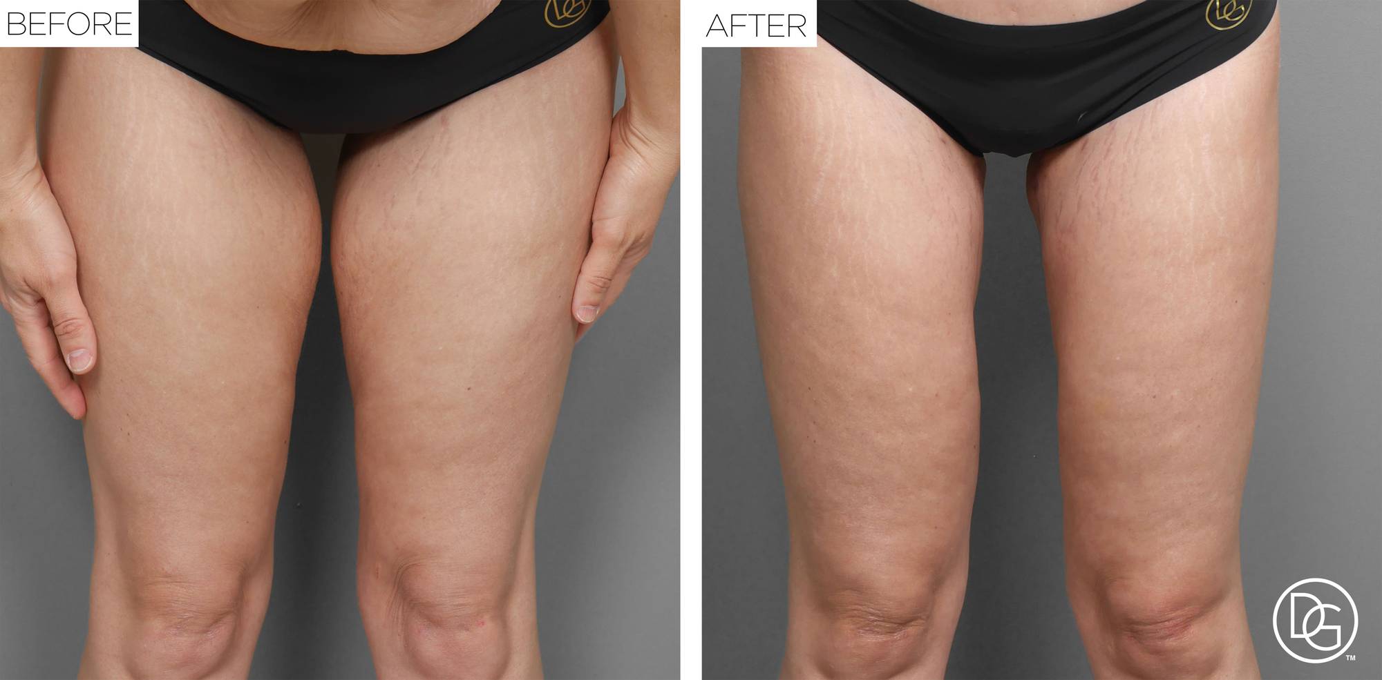 Before & After Image
