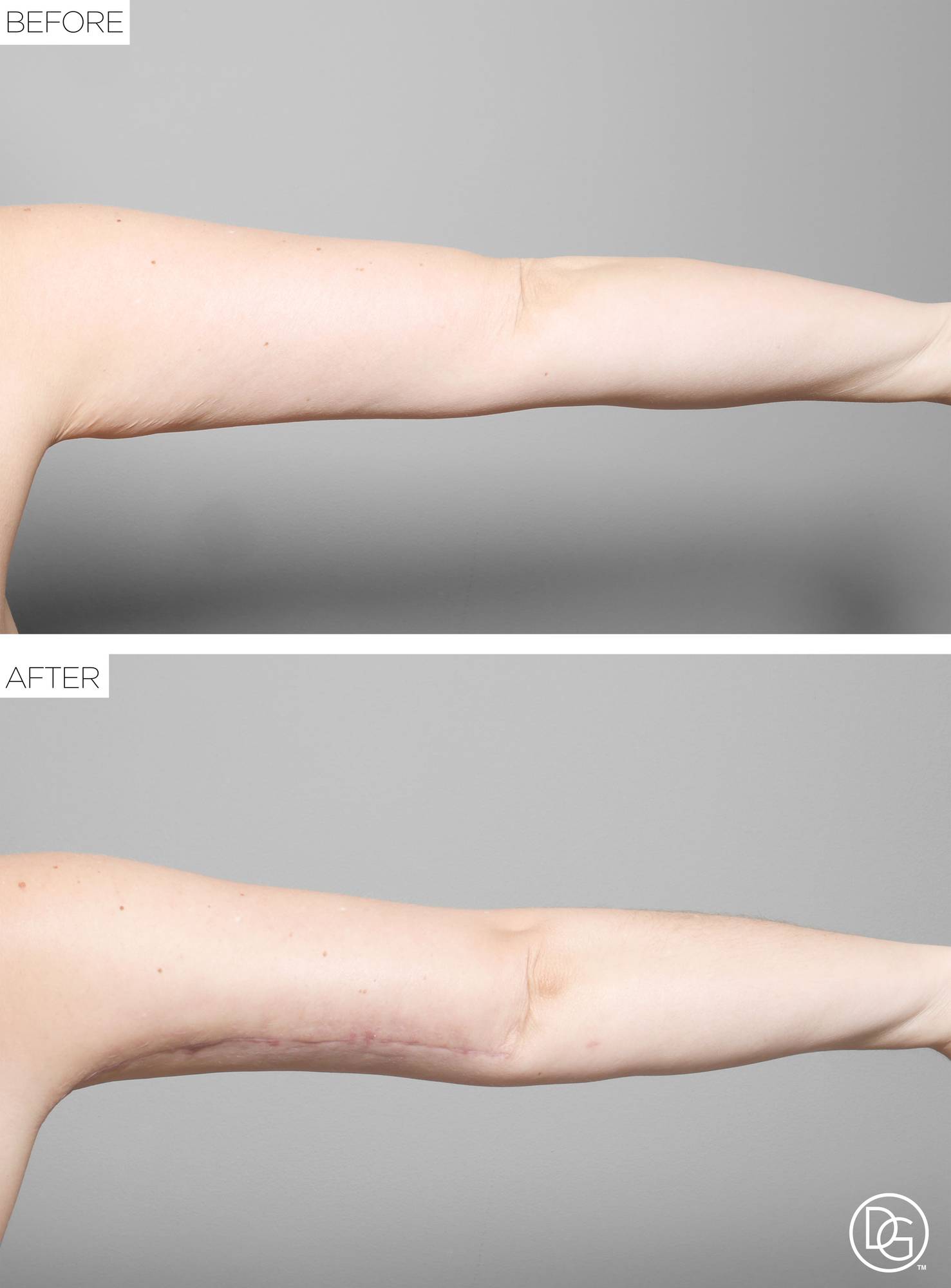 Before & After Image