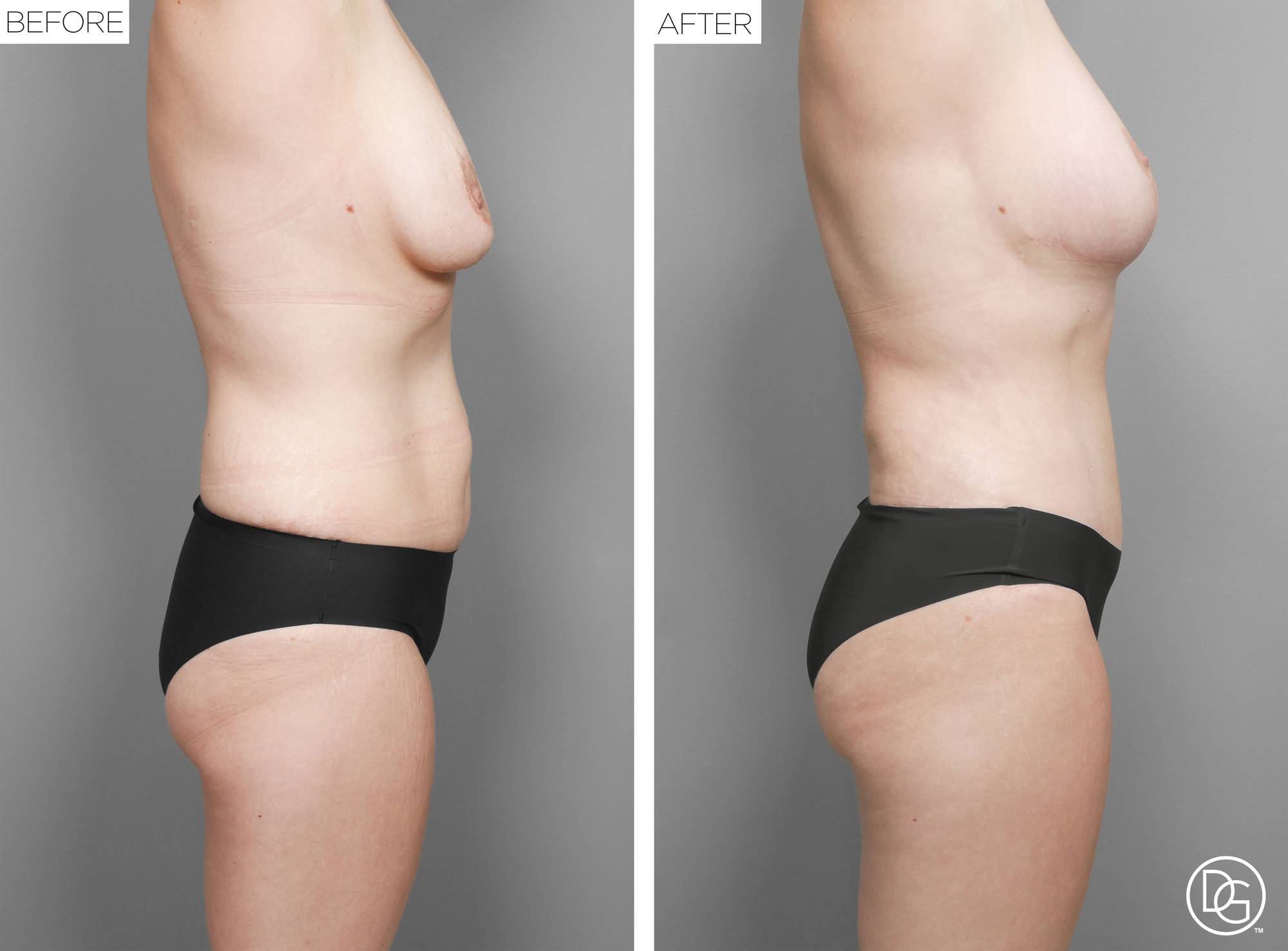 Before & After Image