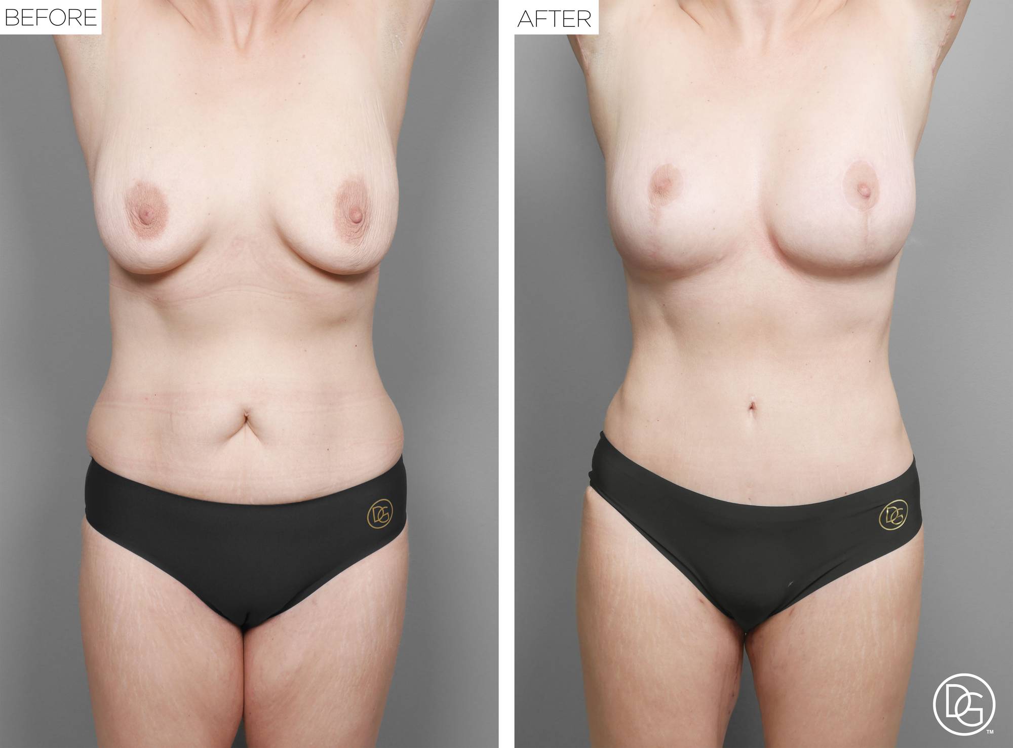 Before & After Image