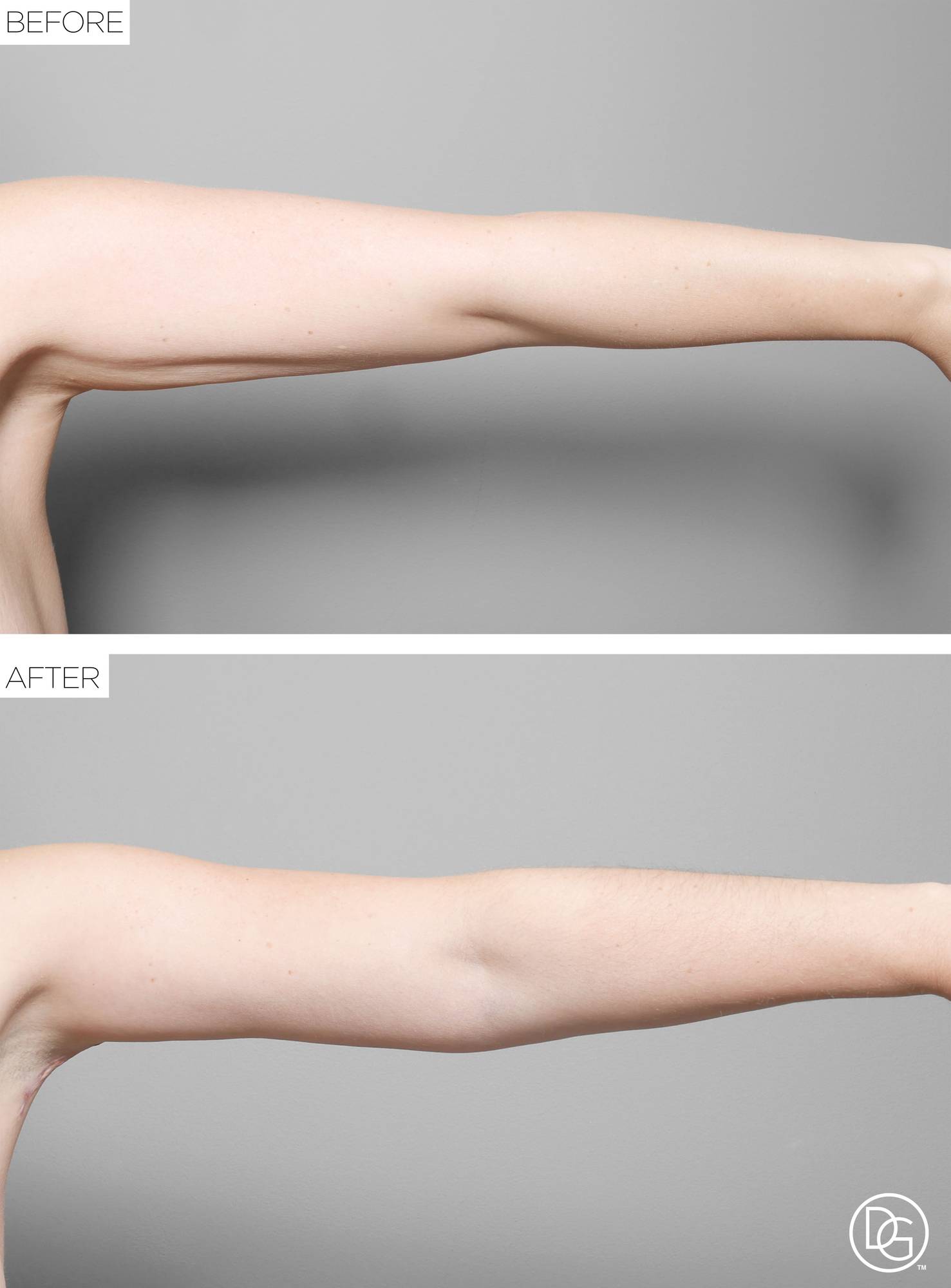 Before & After Image