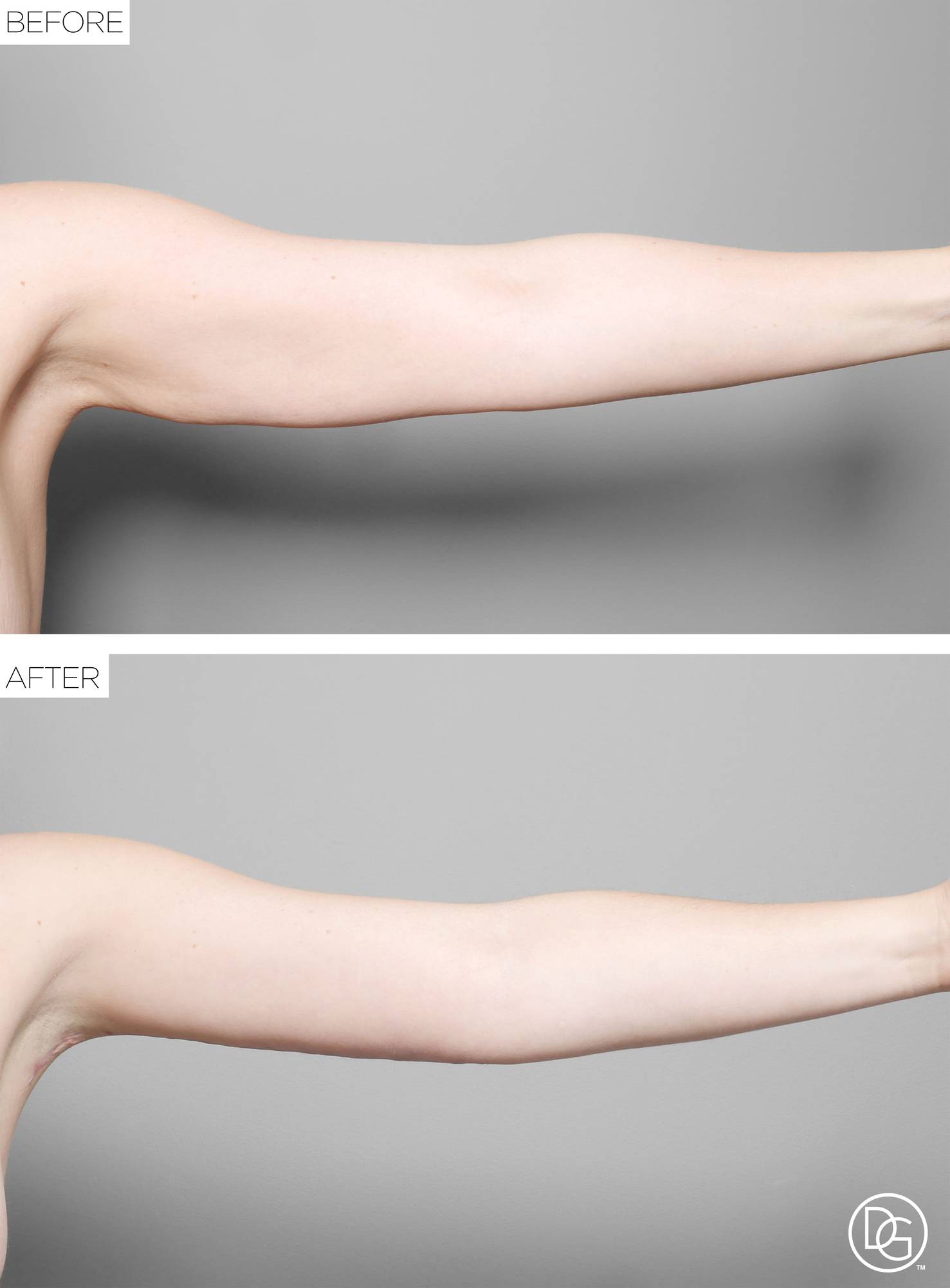 Before & After Image