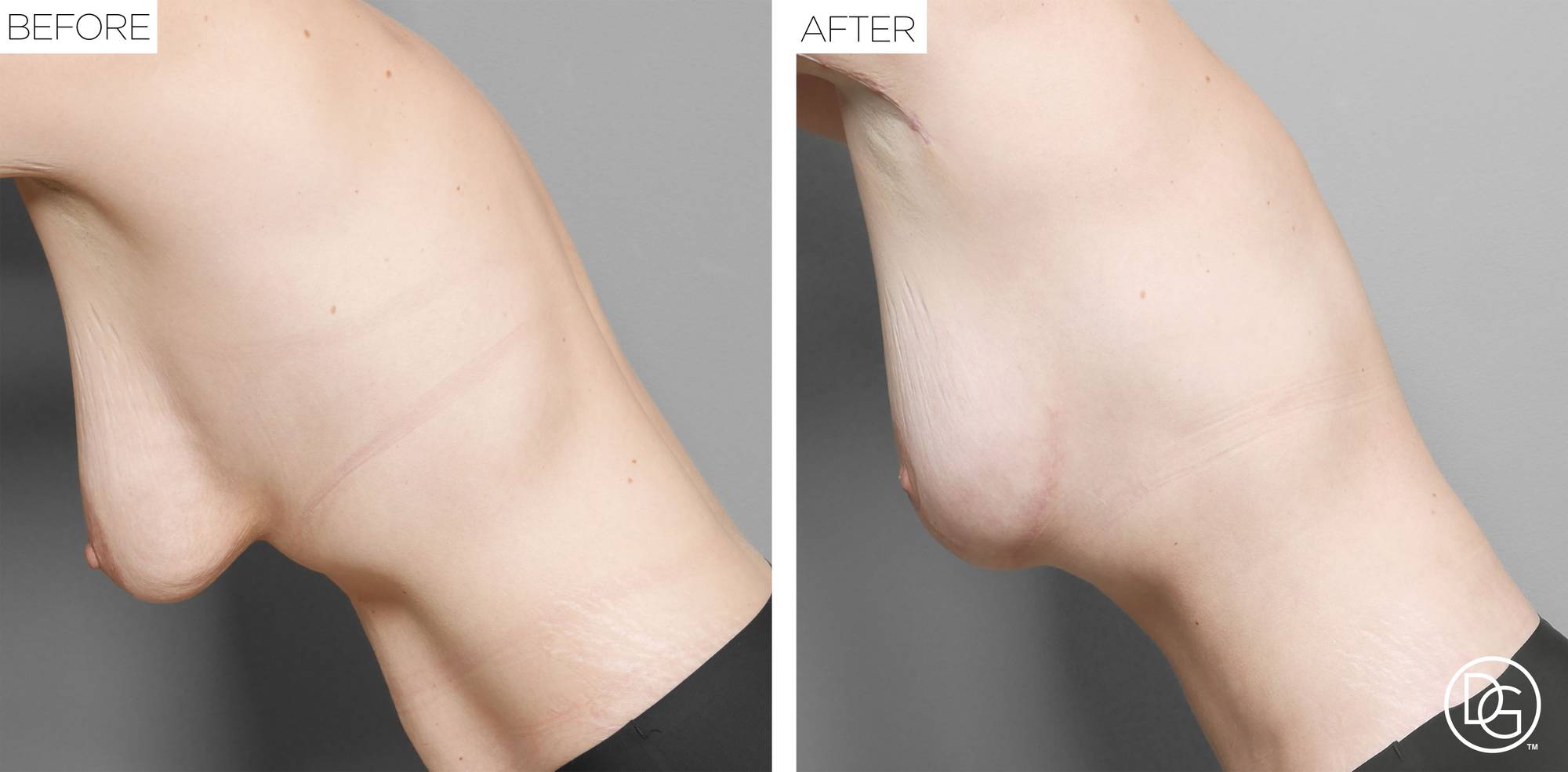 Before & After Image