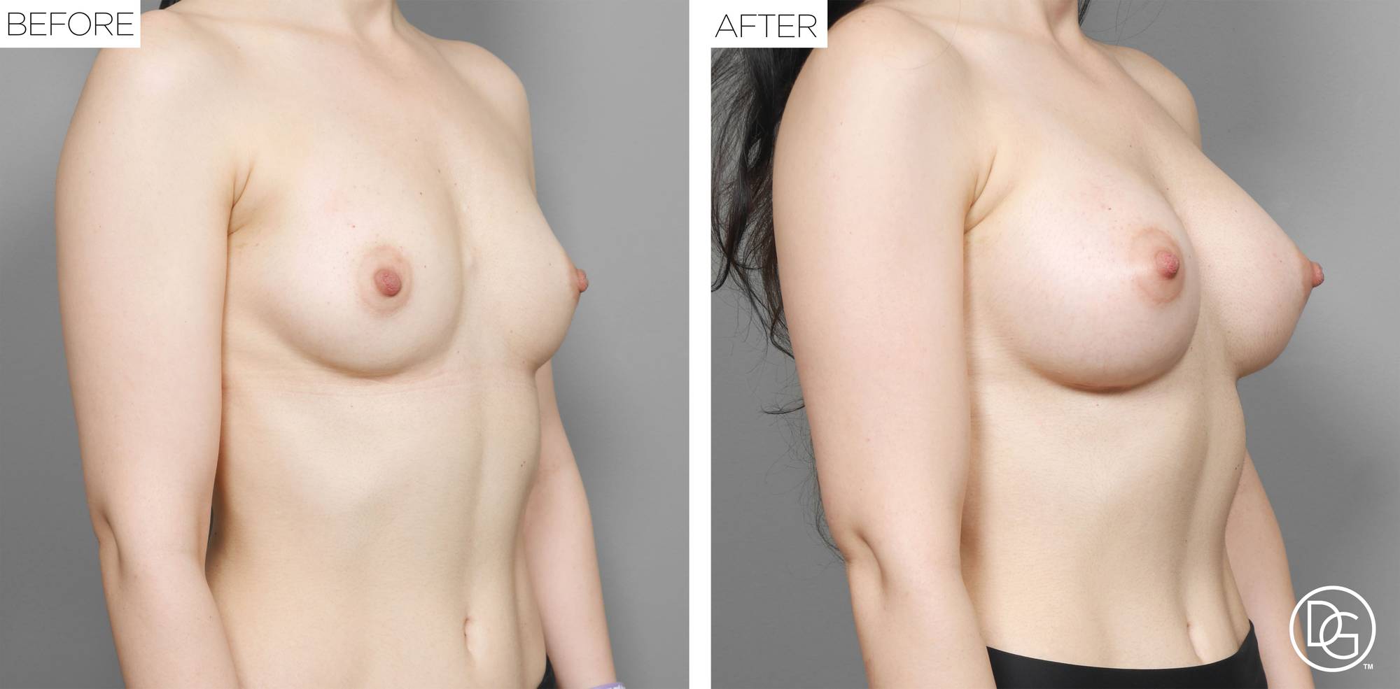 Before & After Image