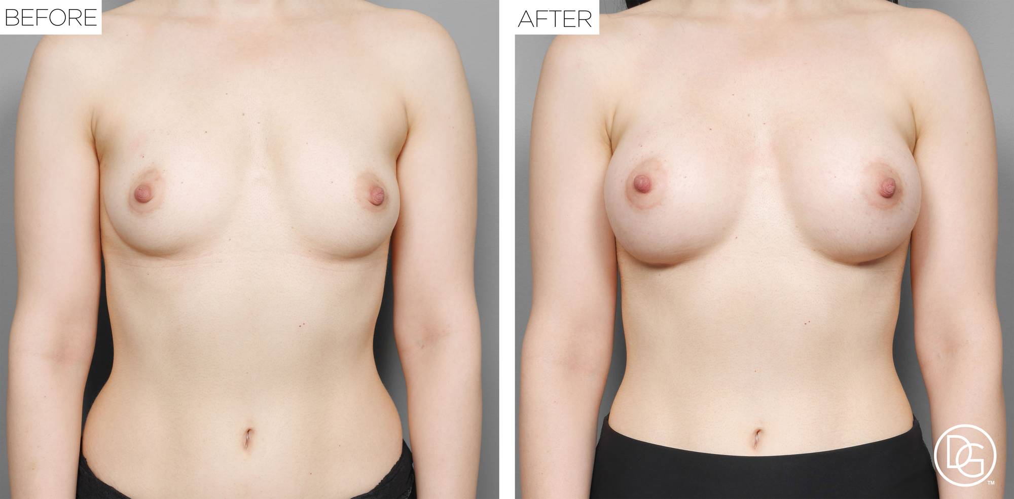 Before & After Image