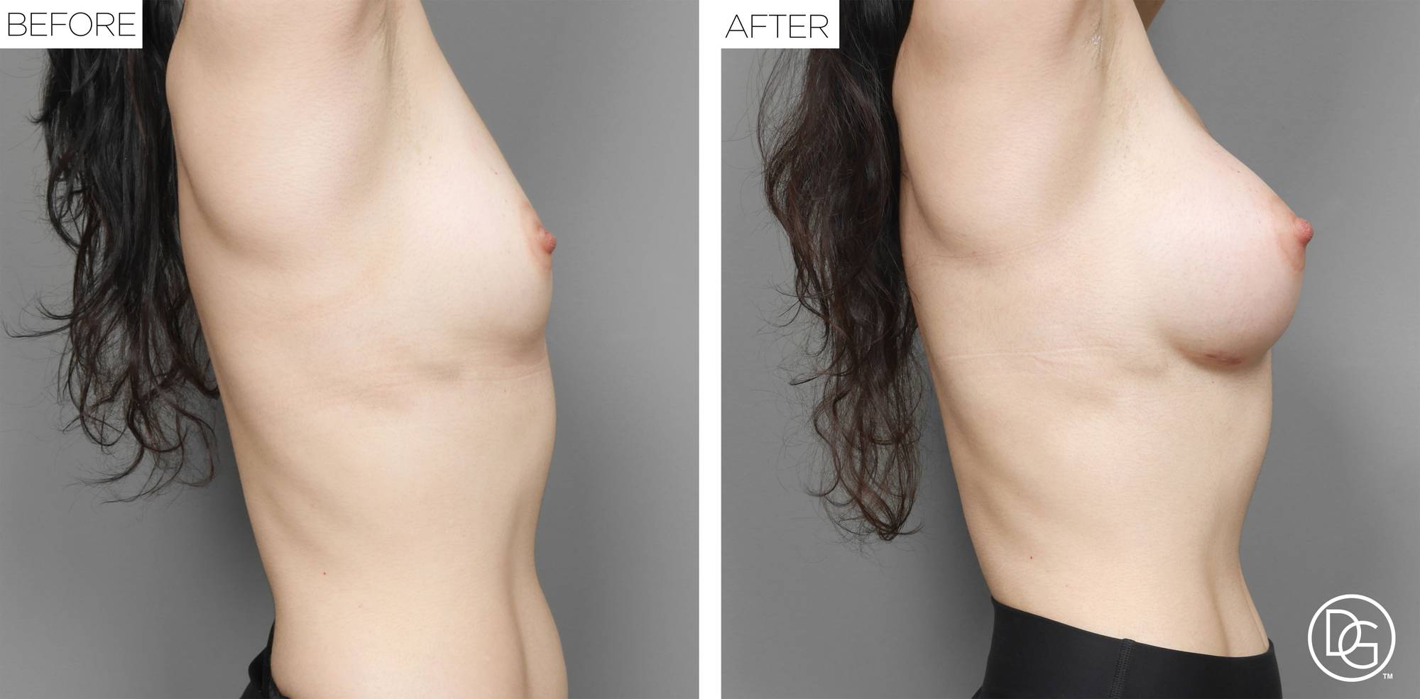 Before & After Image