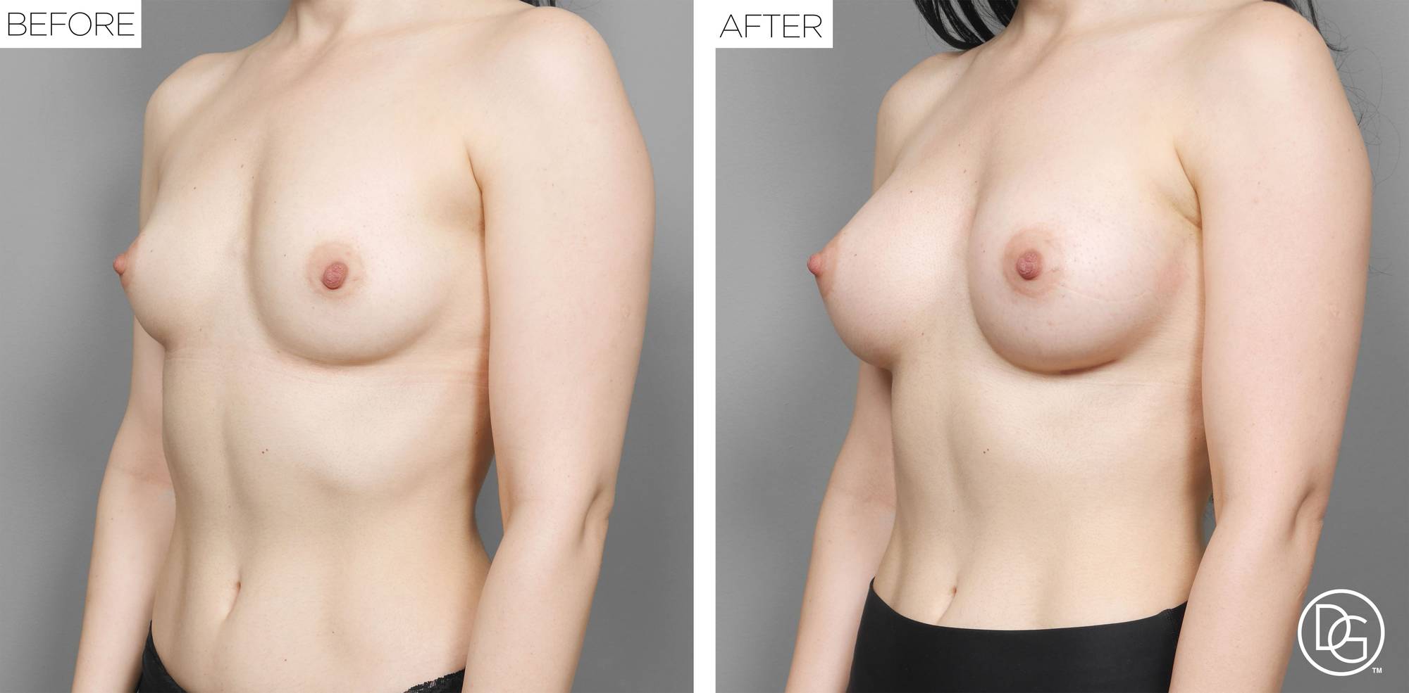 Before & After Image