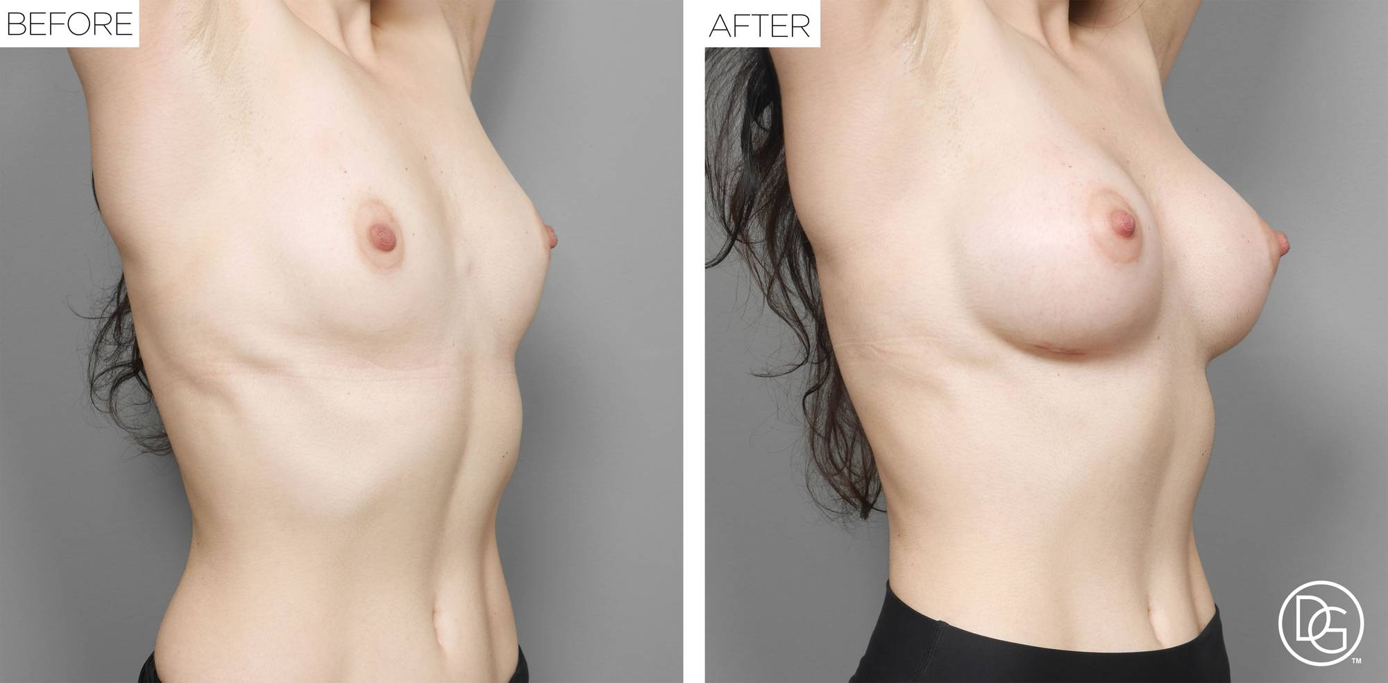 Before & After Image