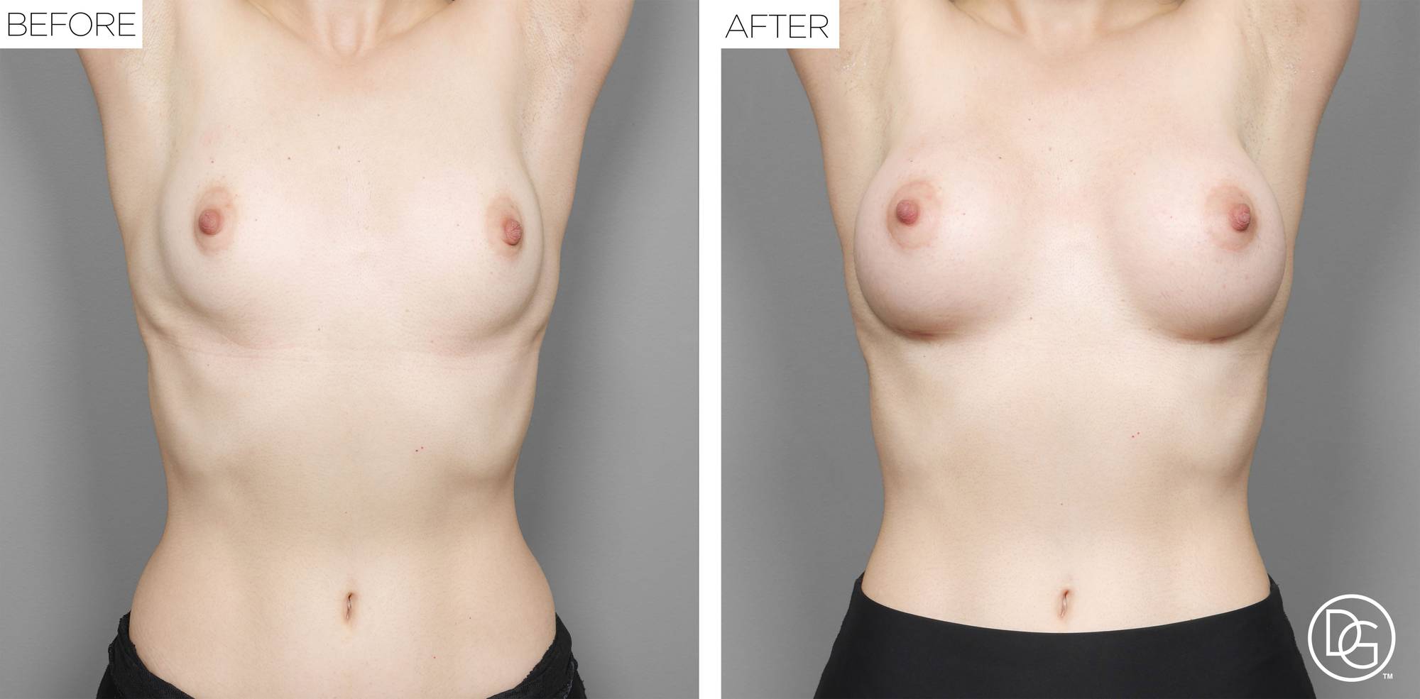 Before & After Image