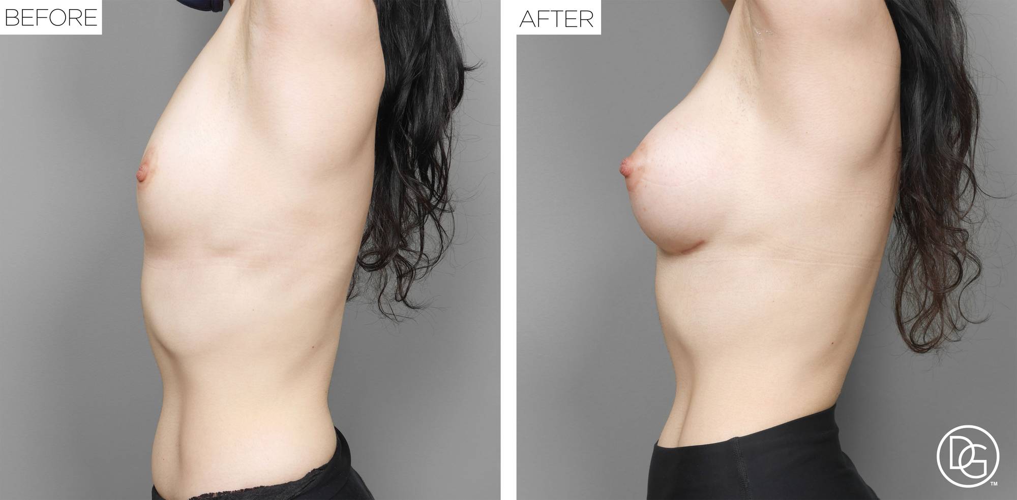 Before & After Image
