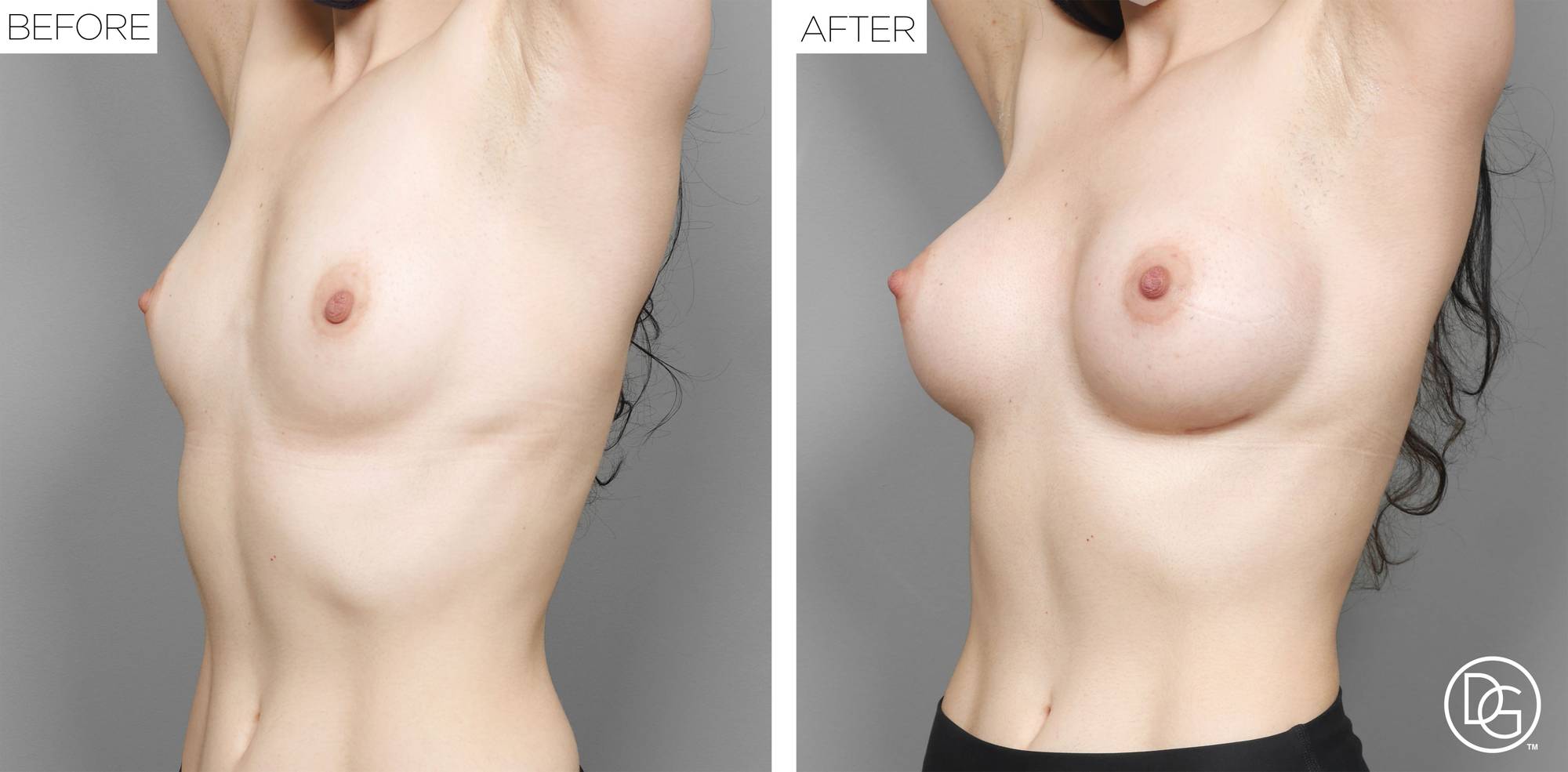 Before & After Image