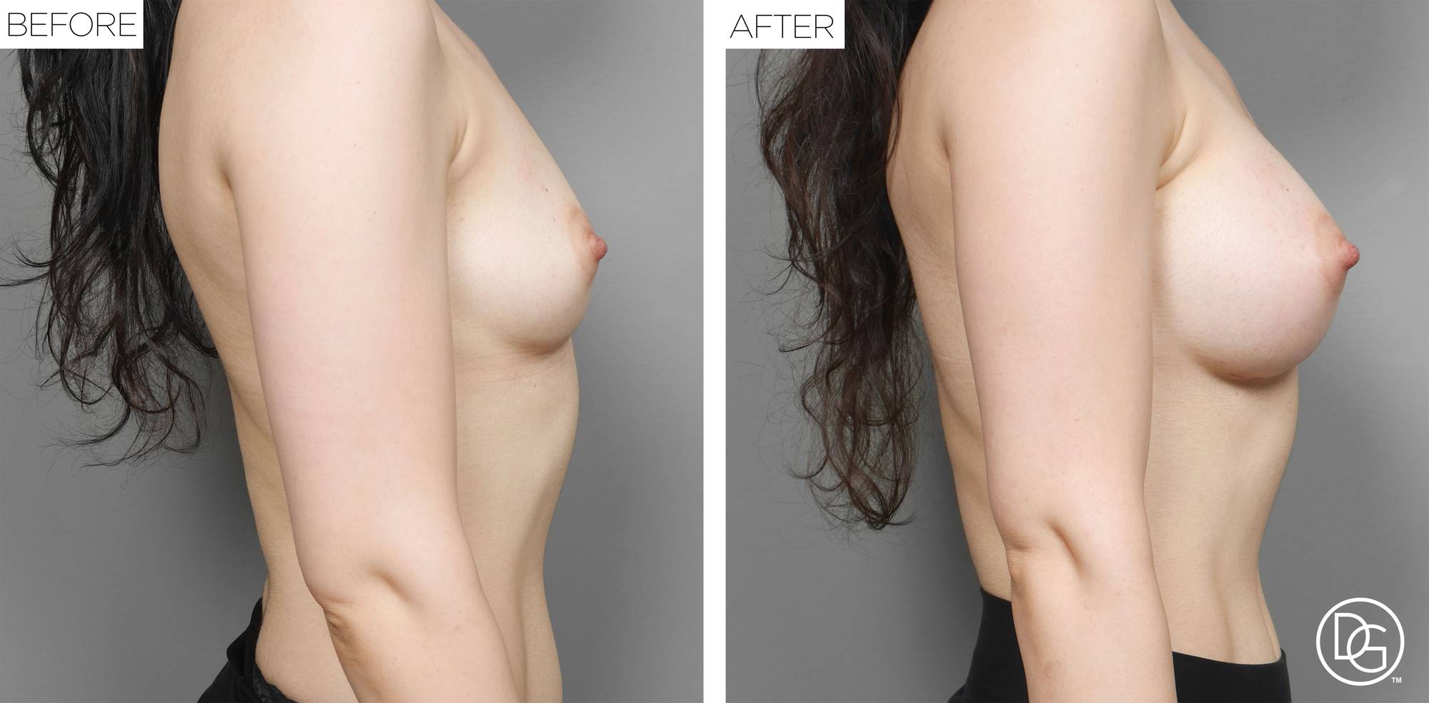 Before & After Image