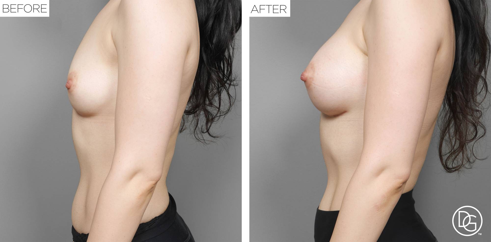 Before & After Image