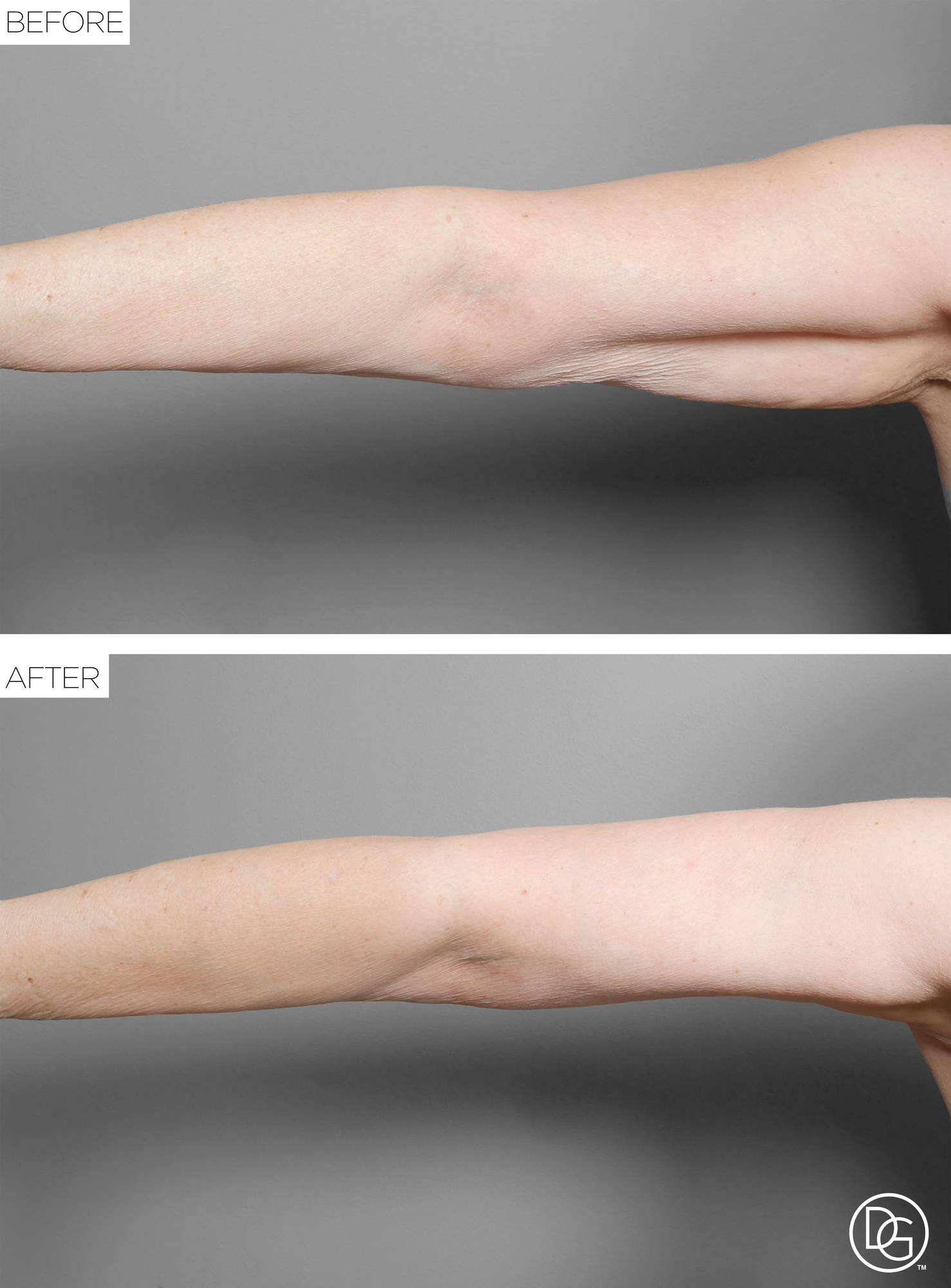 Before & After Image