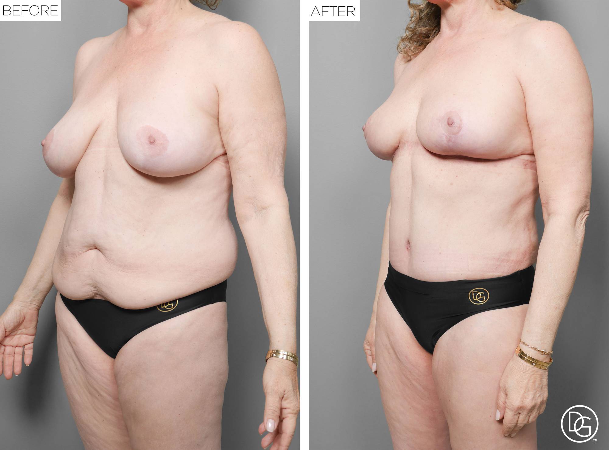 Before & After Image
