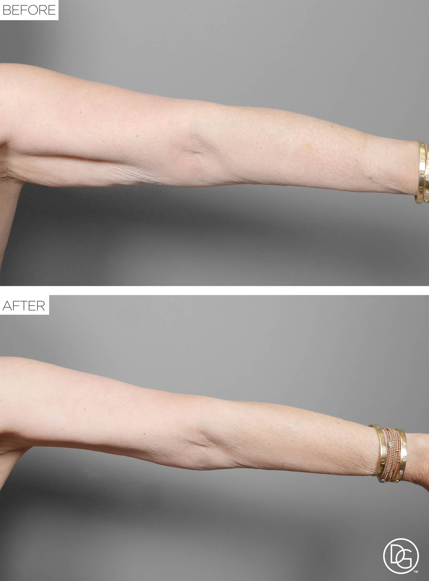 Before & After Image