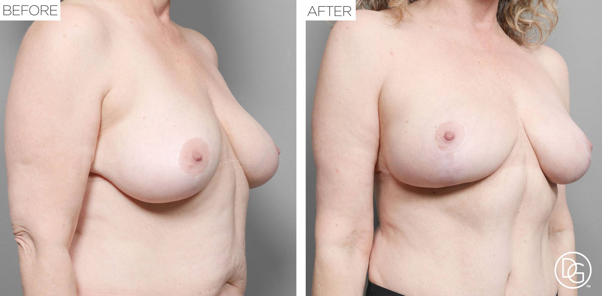 Before & After Image