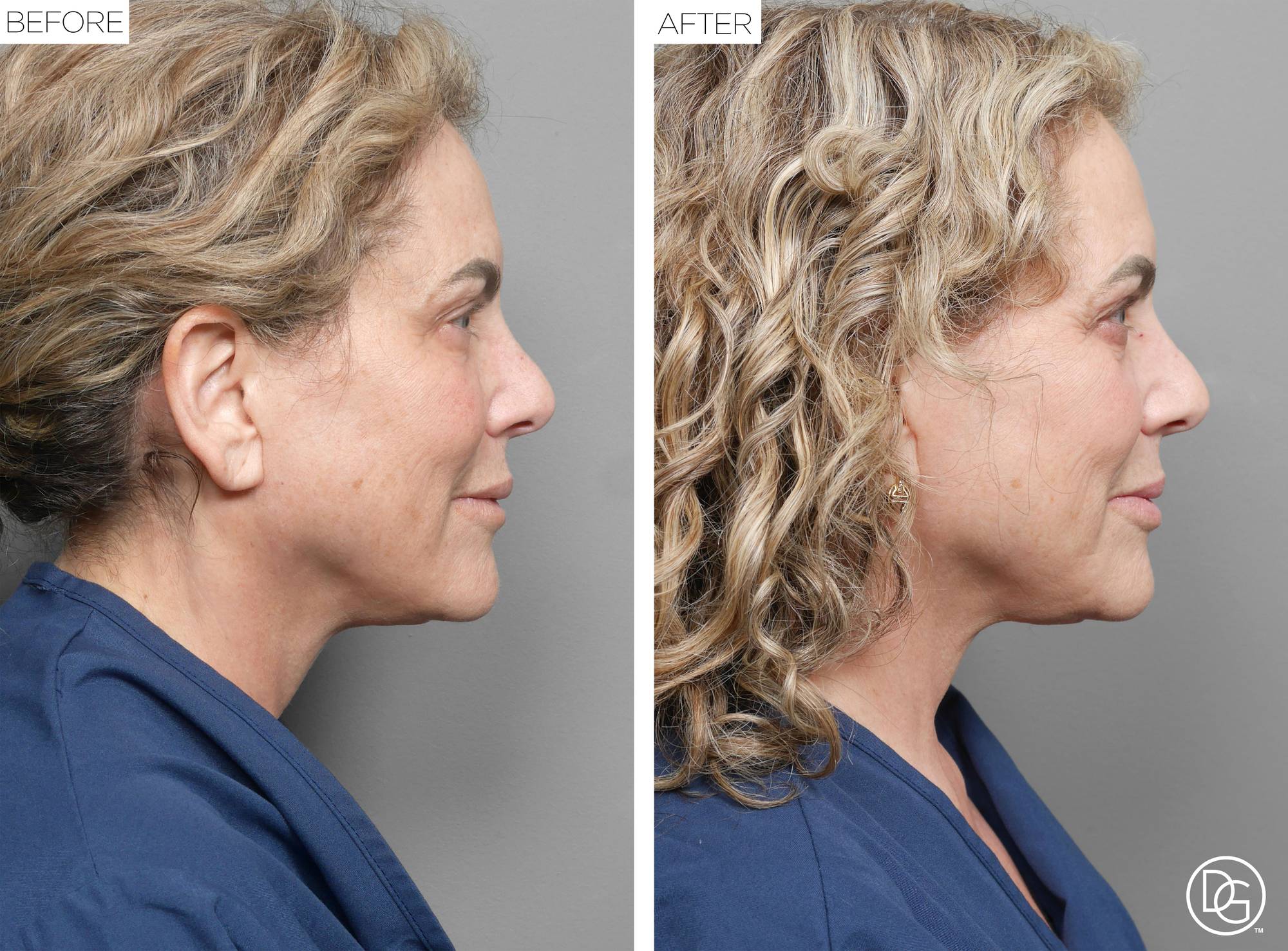 Before & After Image