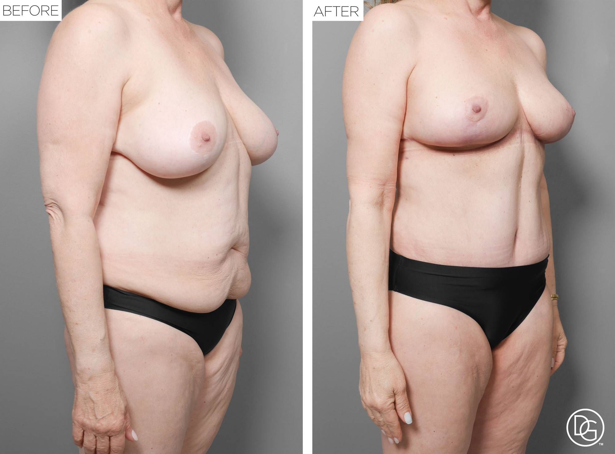 Before & After Image