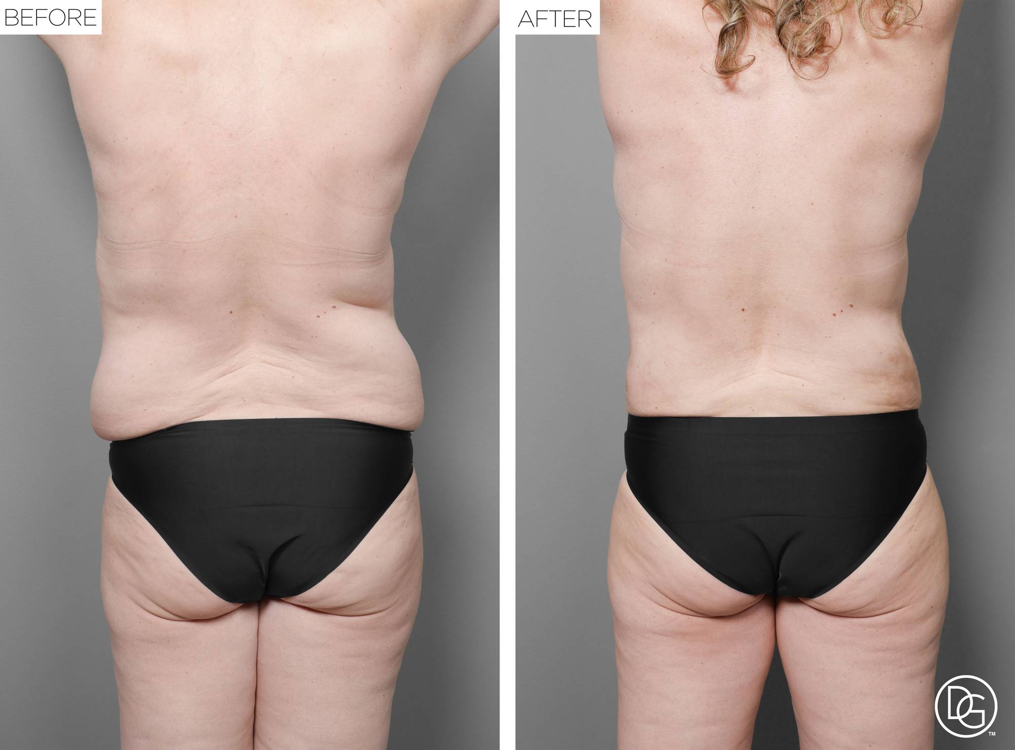 Before & After Image
