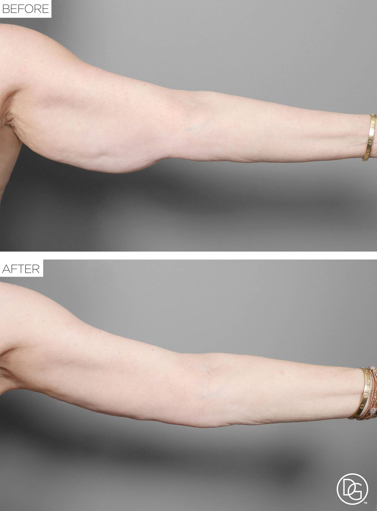 Before & After Image