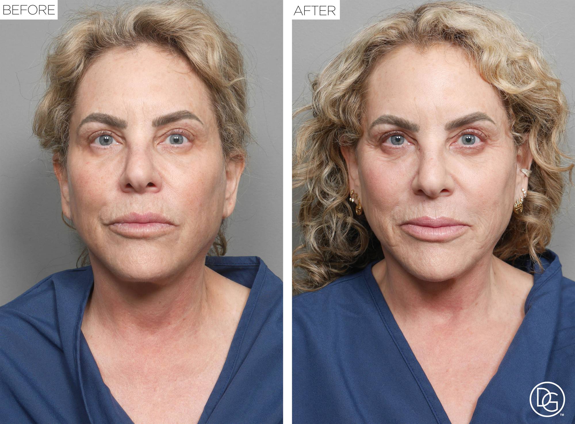 Before & After Image
