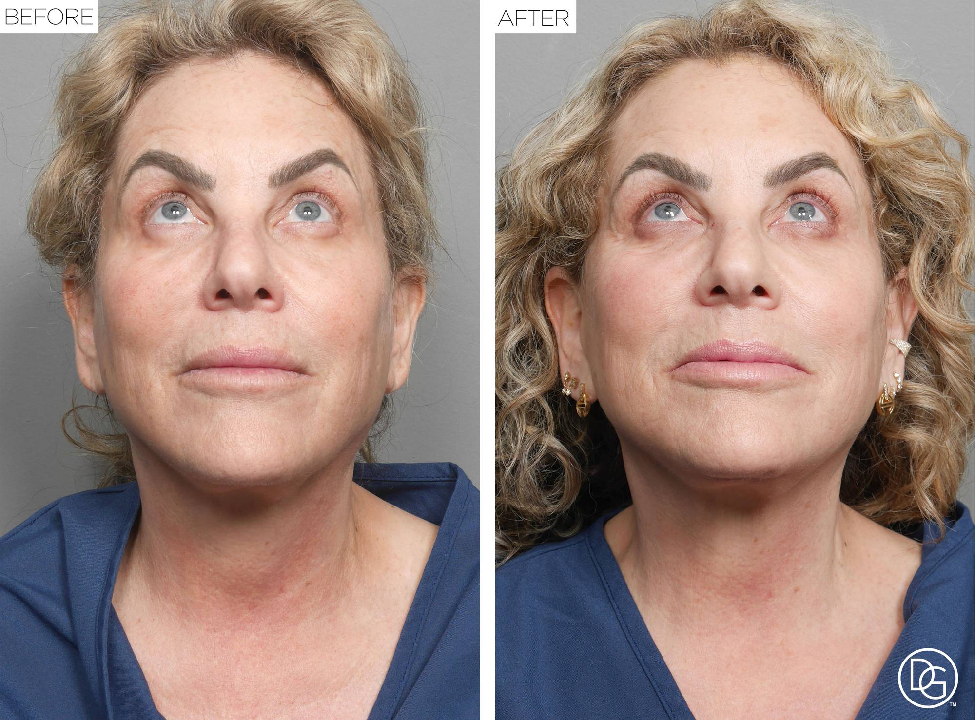 Before & After Image