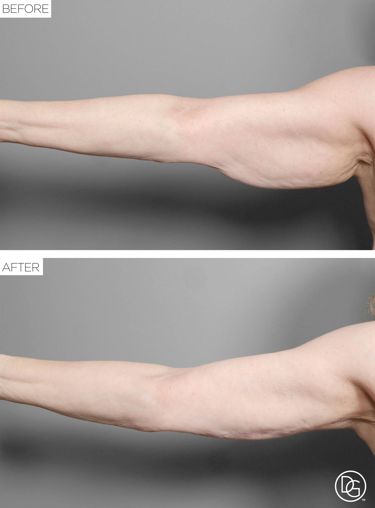 Before & After Image