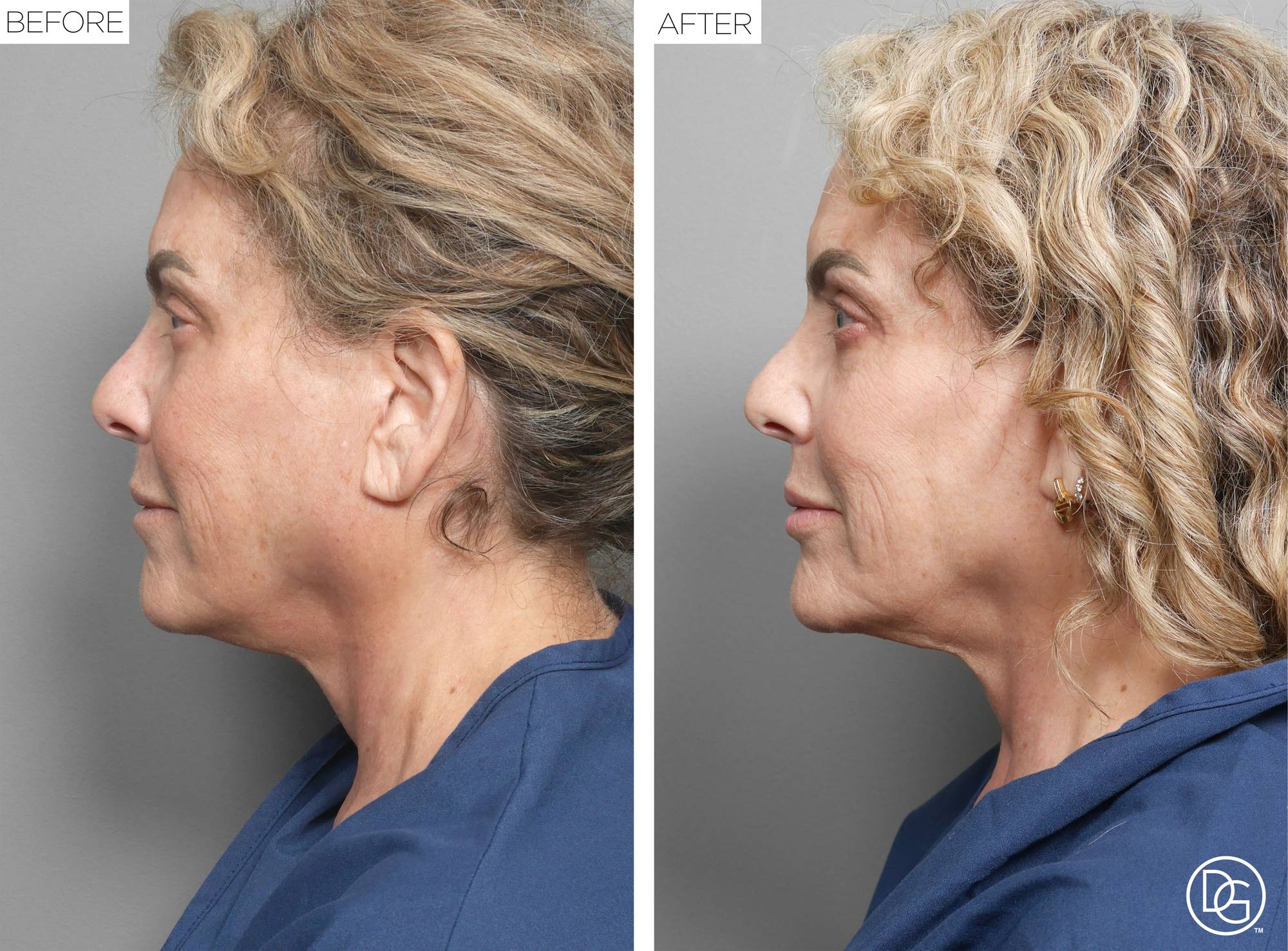 Before & After Image