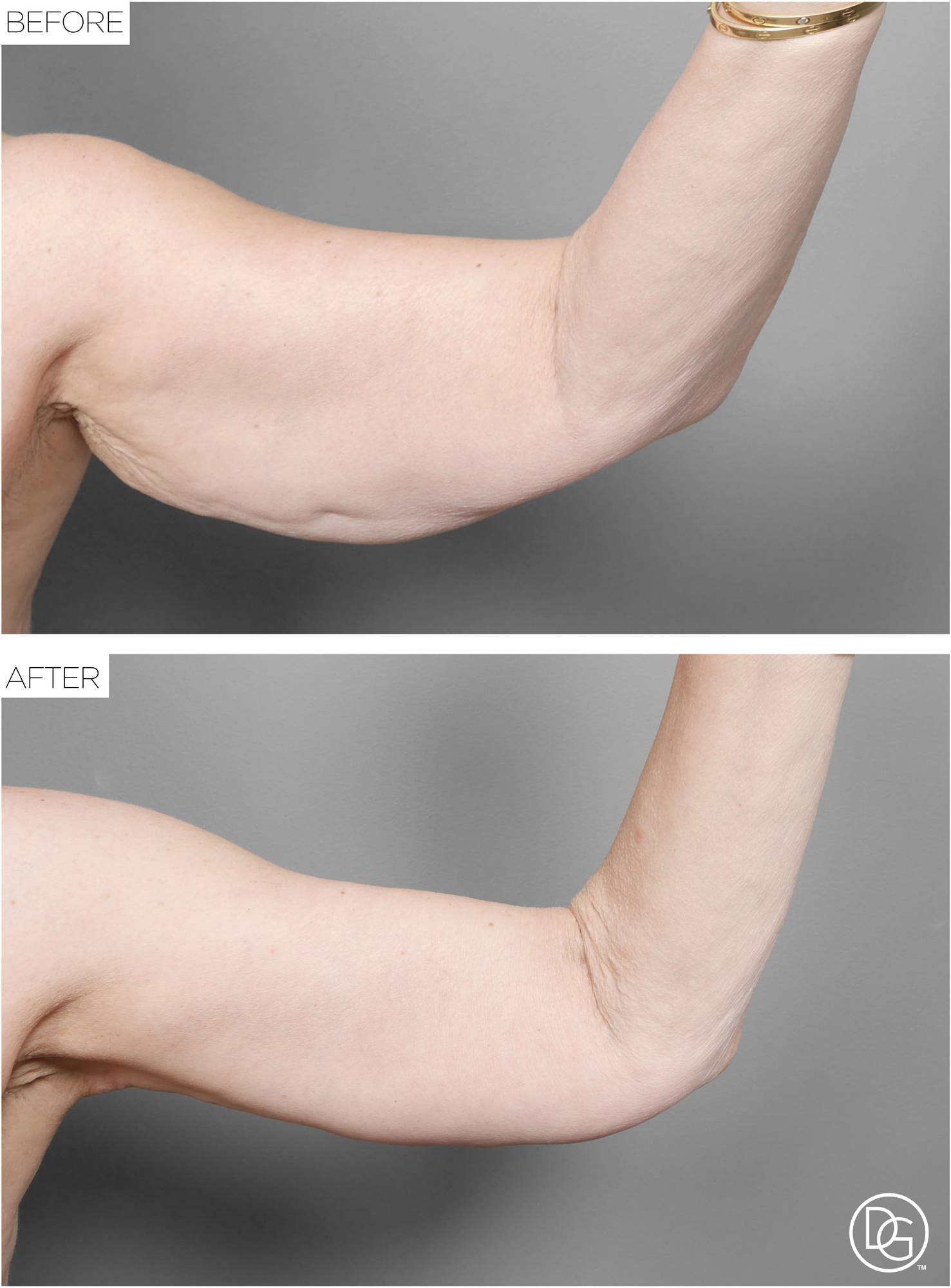 Before & After Image