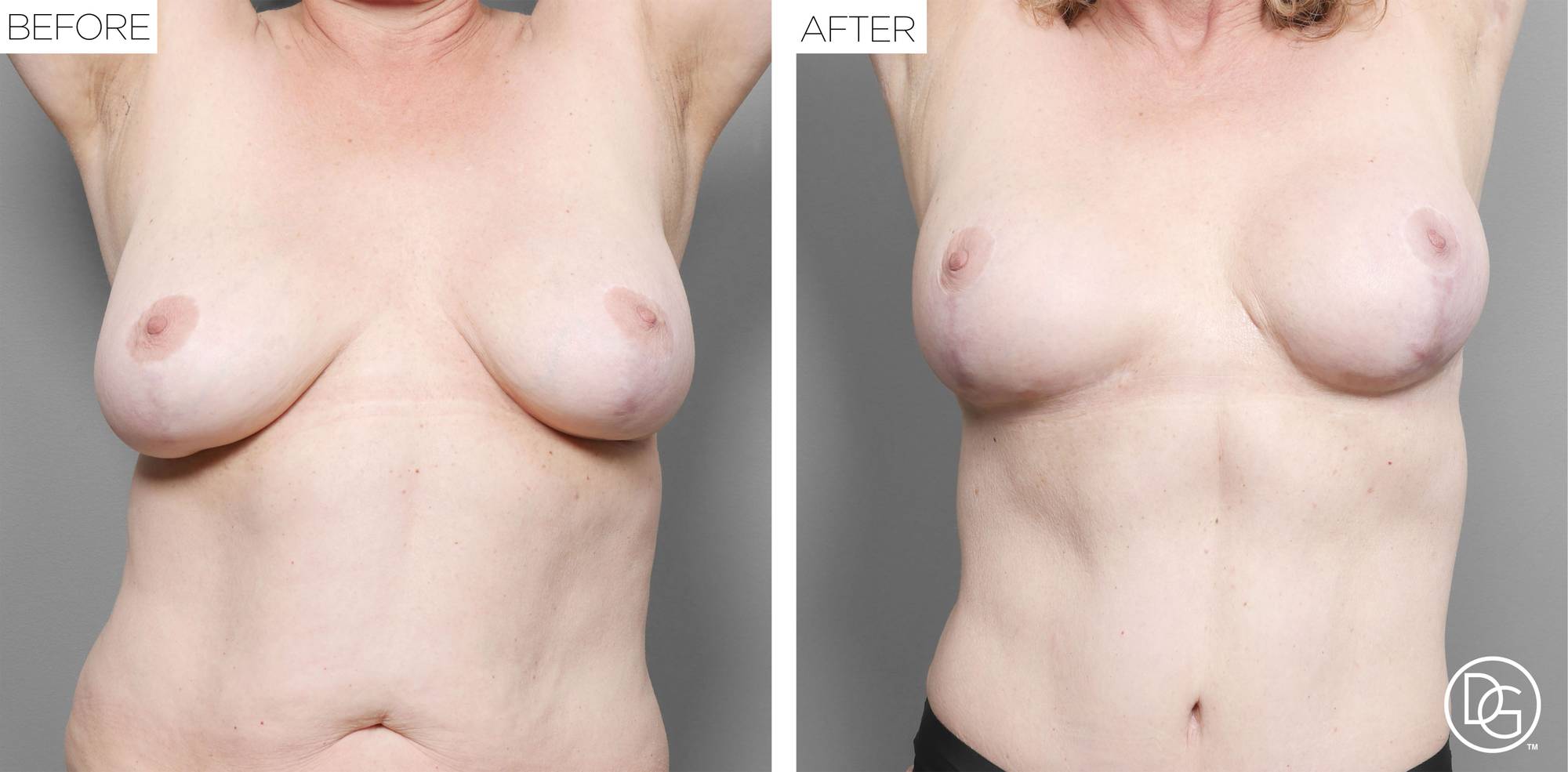 Before & After Image