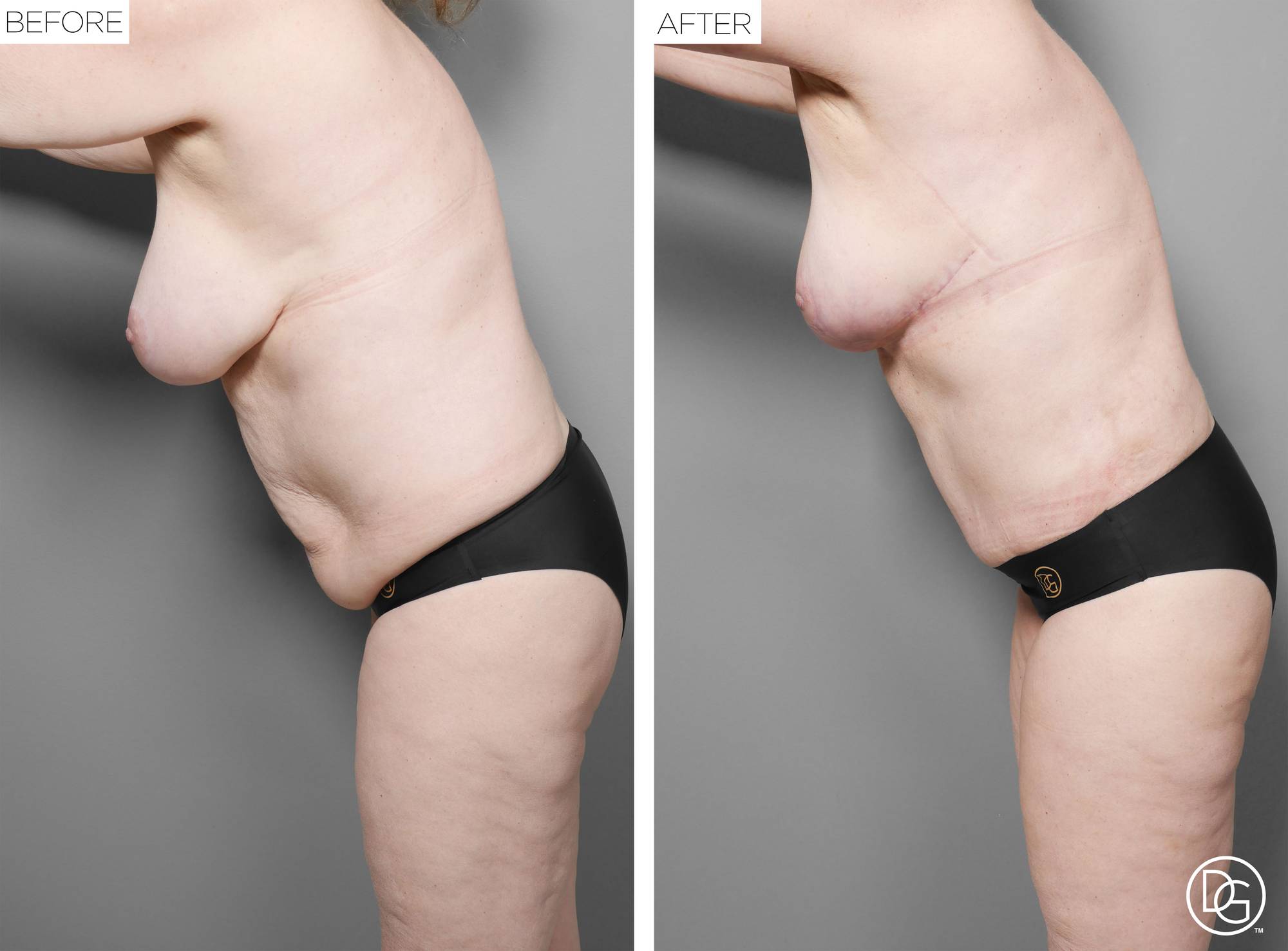 Before & After Image