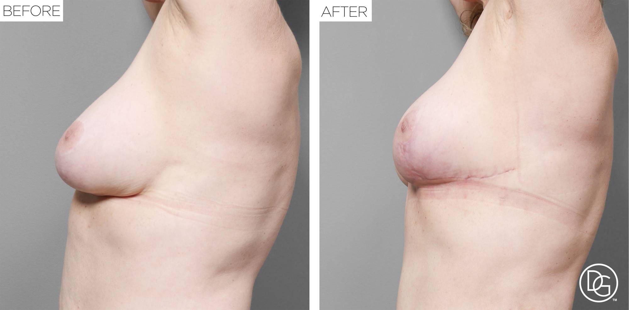 Before & After Image
